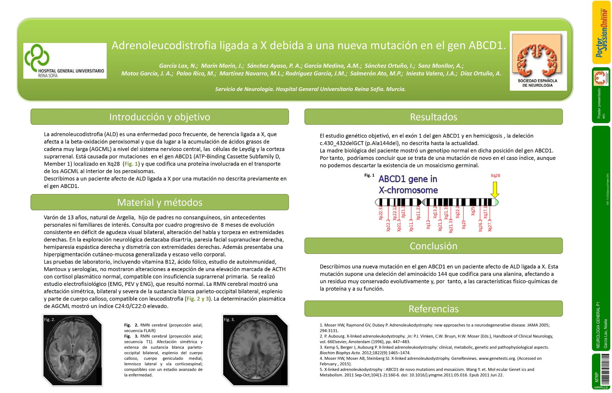Adrenoleucodistrofia ligada a X debida a una nueva mutación en el gen ABCD1