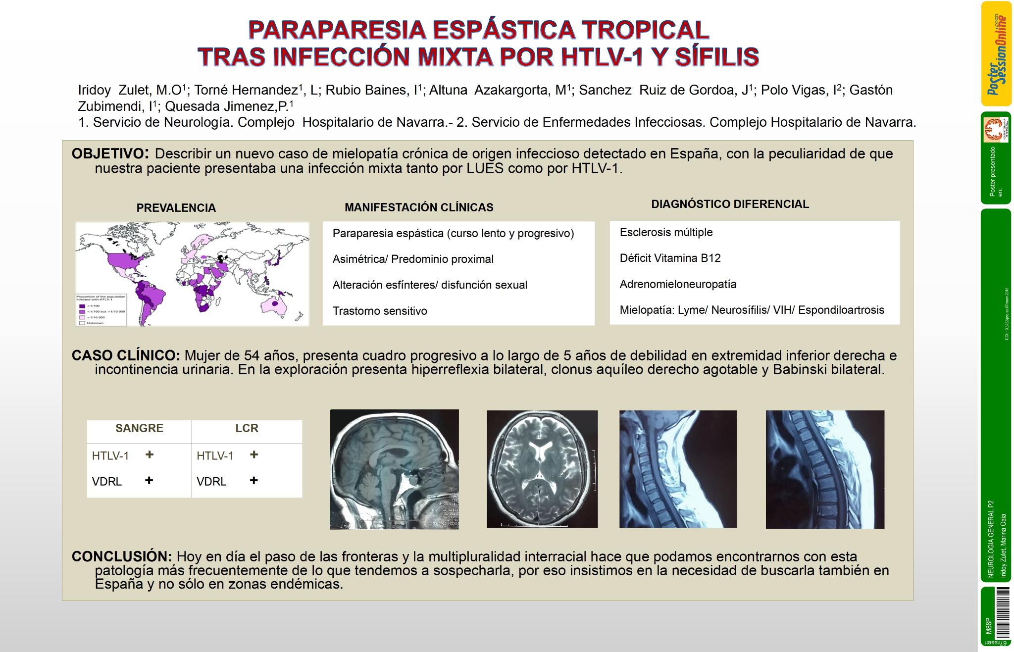 Paraparesia espástica tropical tras coinfección por HTLV-1 y Neurolues