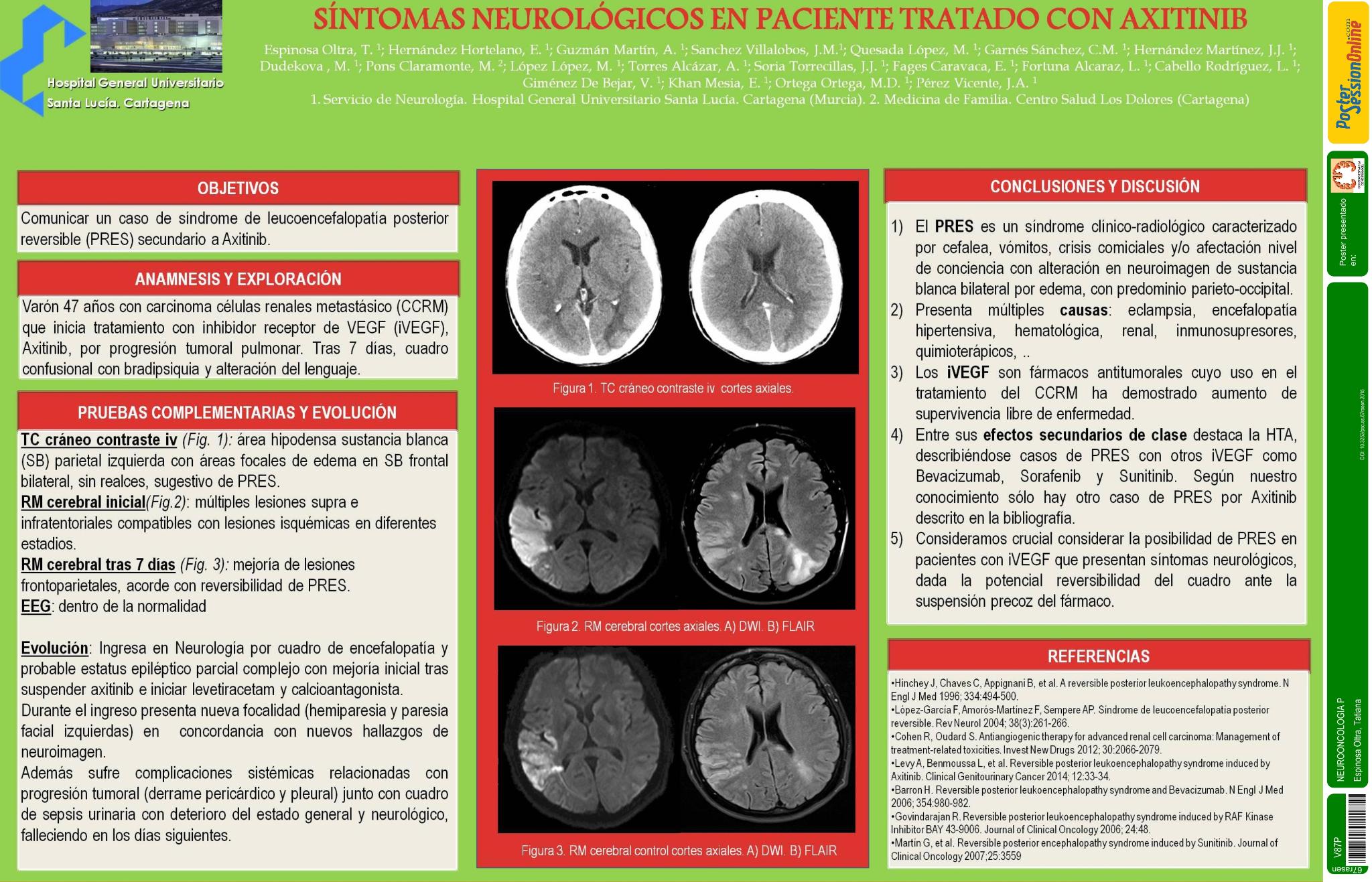 Síntomas neurológicos en paciente tratado con Axitinib