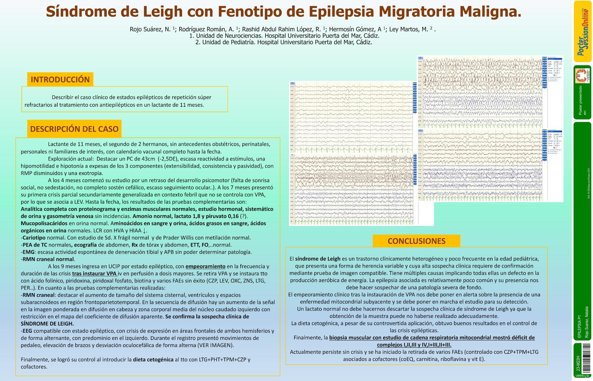 Síndrome de Leigh con Fenotipo de Epilepsia Migratoria Maligna