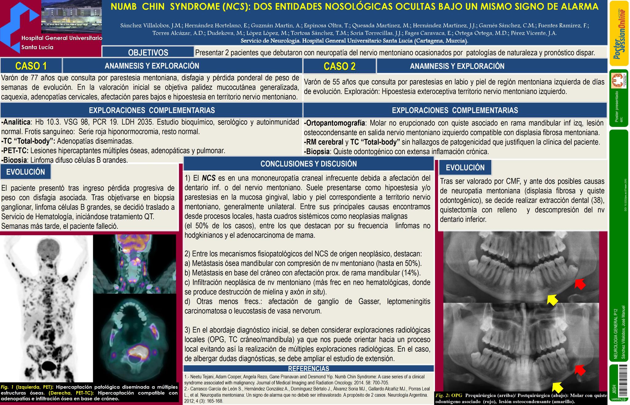 Numb Chin Syndrome (NCS): dos entidades nosológicas ocultas bajo un mismo signo de alarma