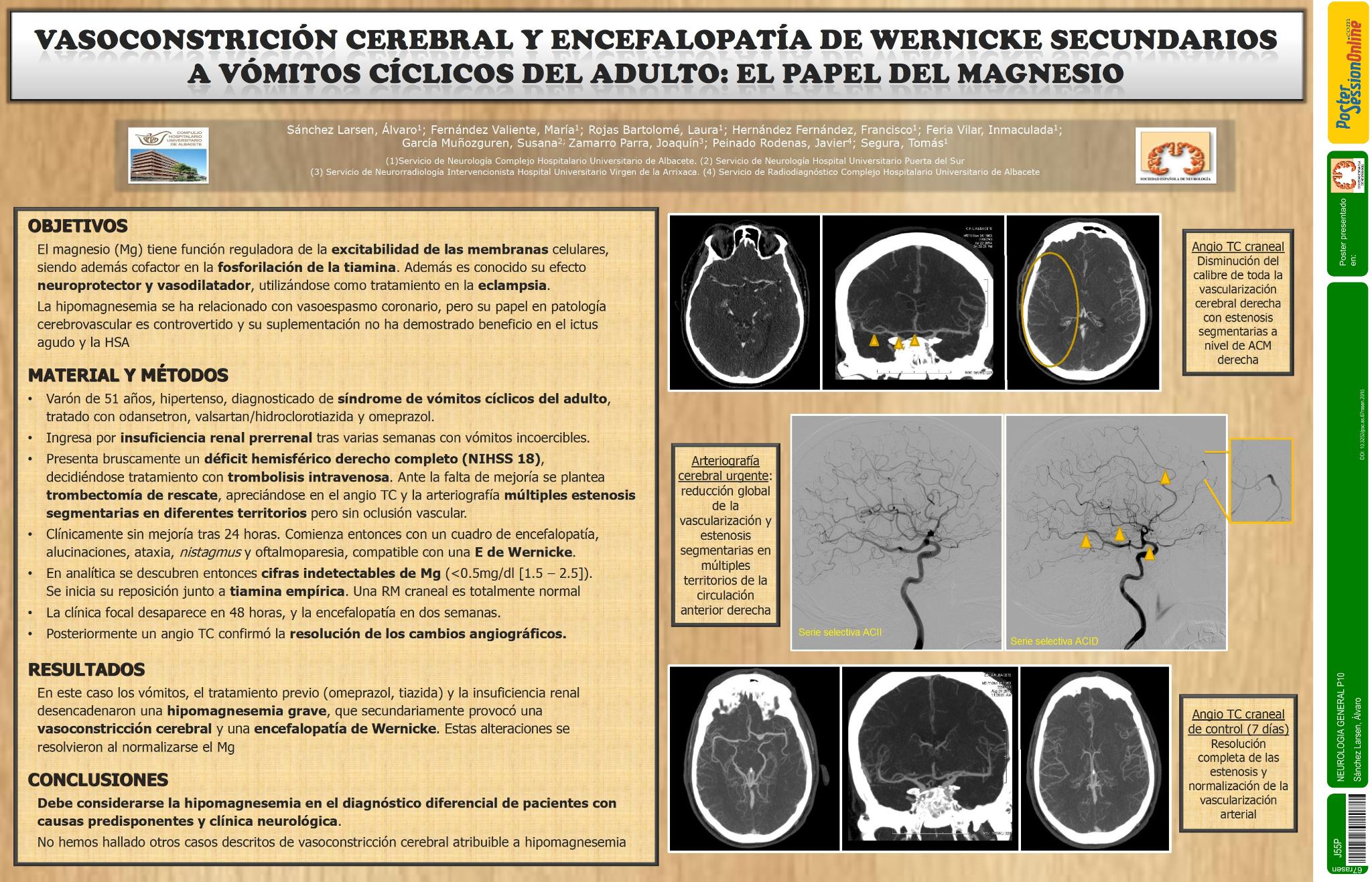 Vasoconstrición cerebral y encefalopatía de Wernicke secundarios a vómitos cíclicos del adulto: el papel del magnesio