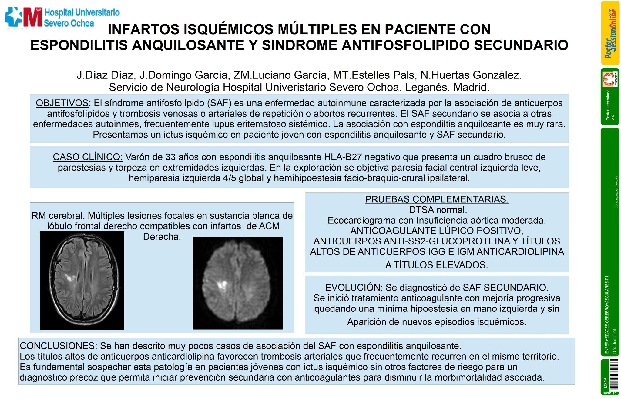 Infartos isquémicos múltiples en paciente con espondilitis anquilosante y sindrome antifosfolipido secundario