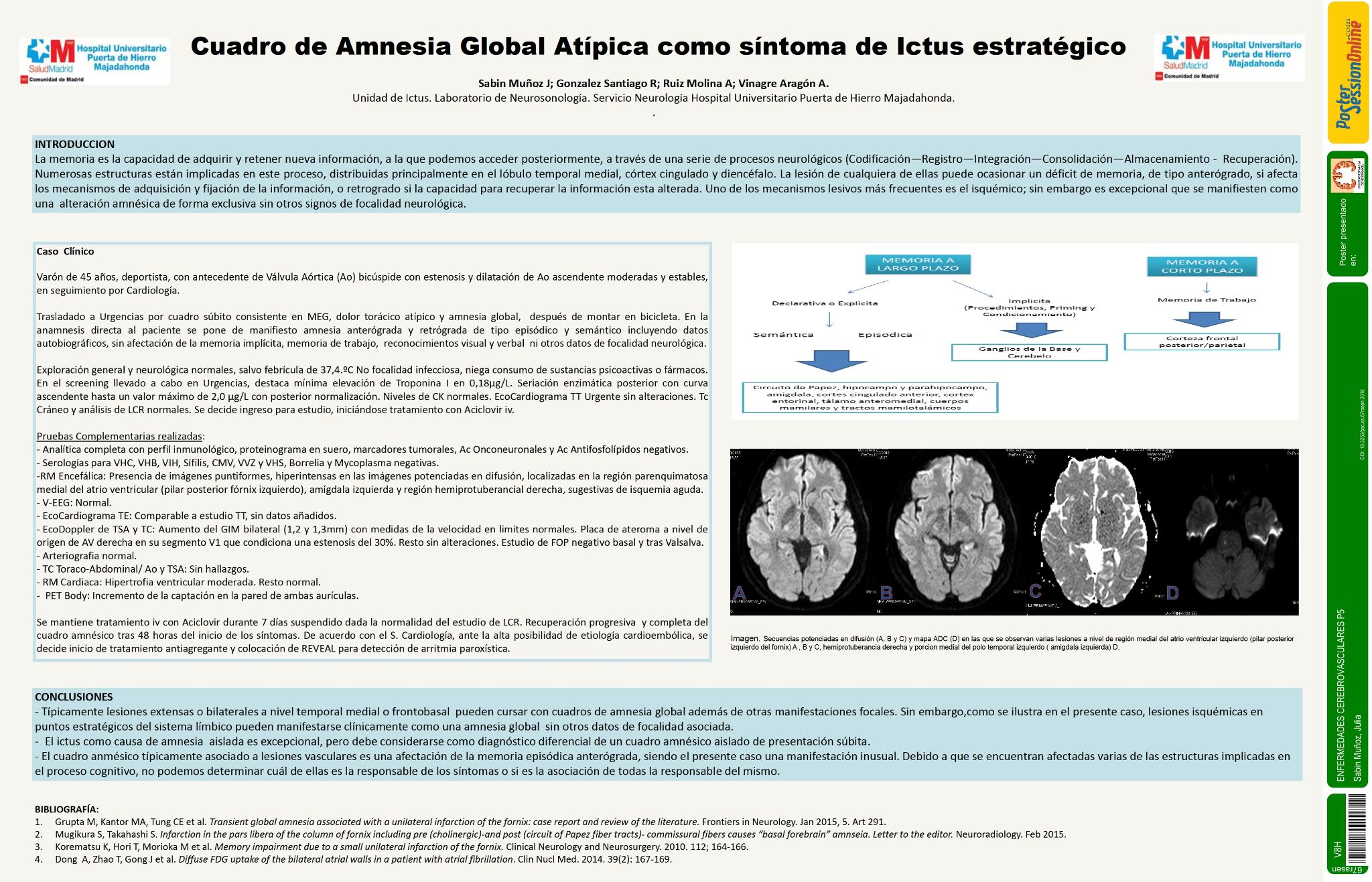 Cuadro de amnesia global atípica como síntoma de Ictus estratégico