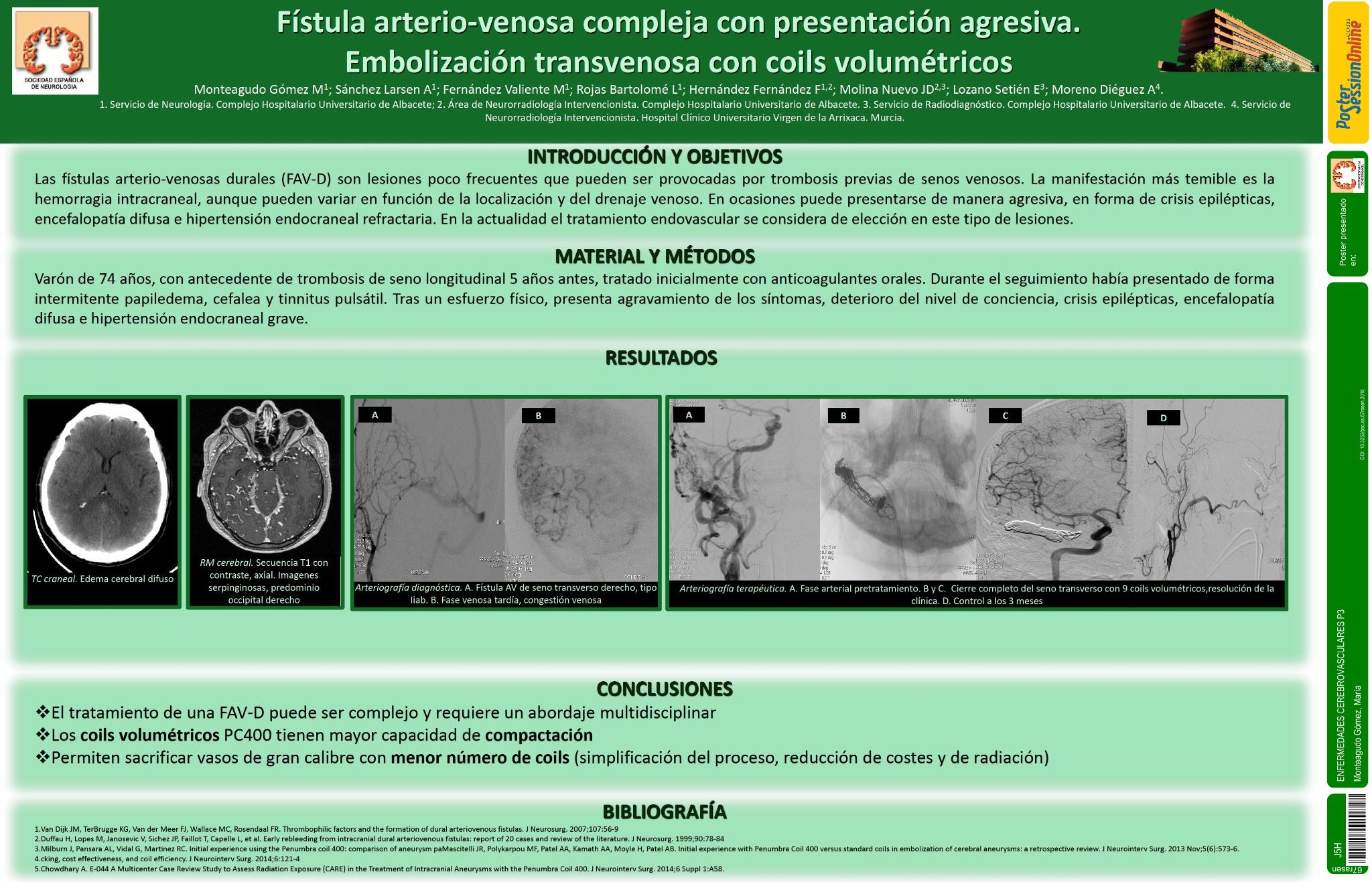 Presentación agresiva de fístula arterio-venosa compleja. Embolización transvenosa con coils volumétricos