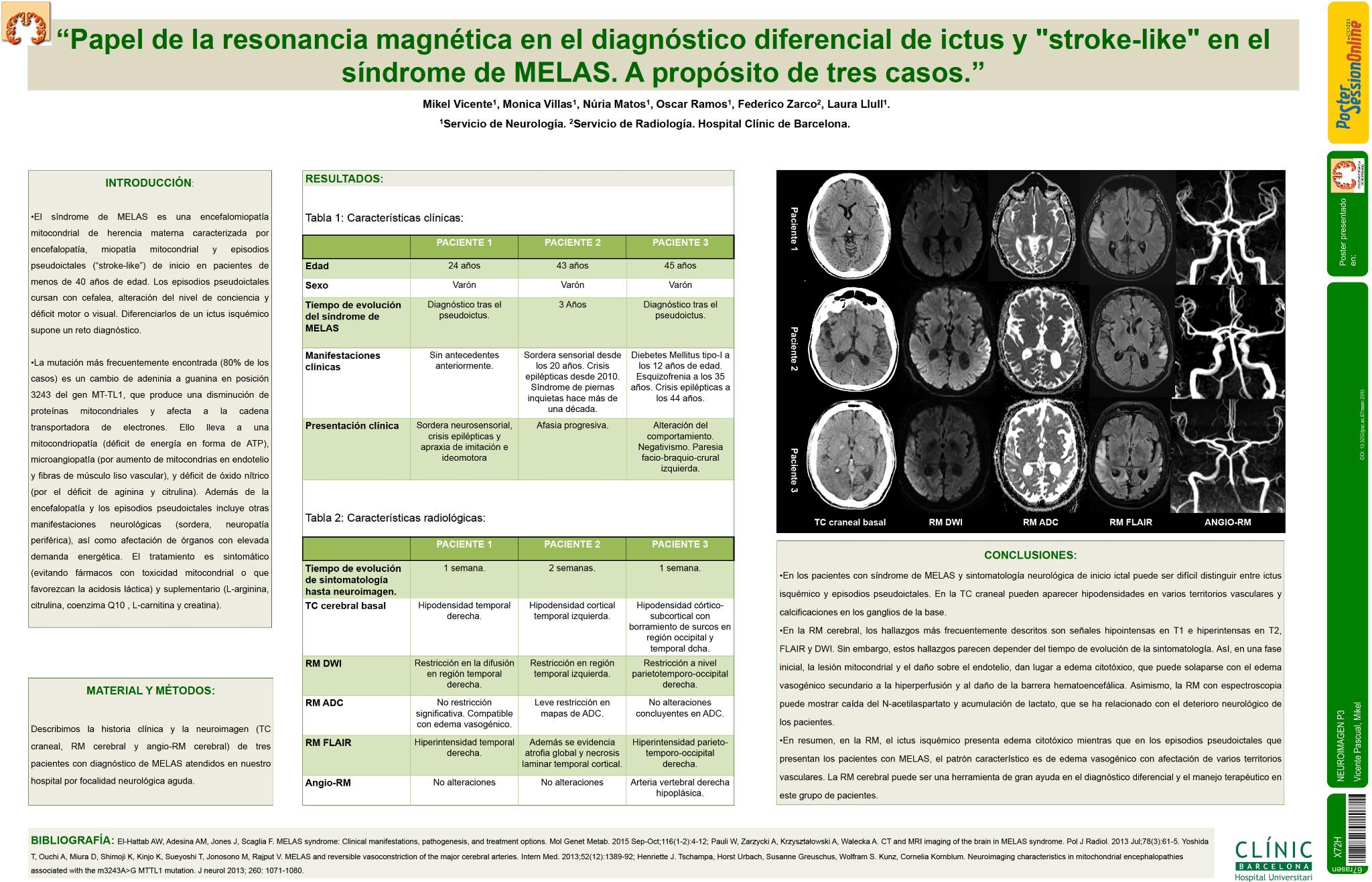 Papel de la resonancia magnética en el diagnóstico diferencial de ictus y "stroke-like" en el síndrome de MELAS. A propósito de tres casos