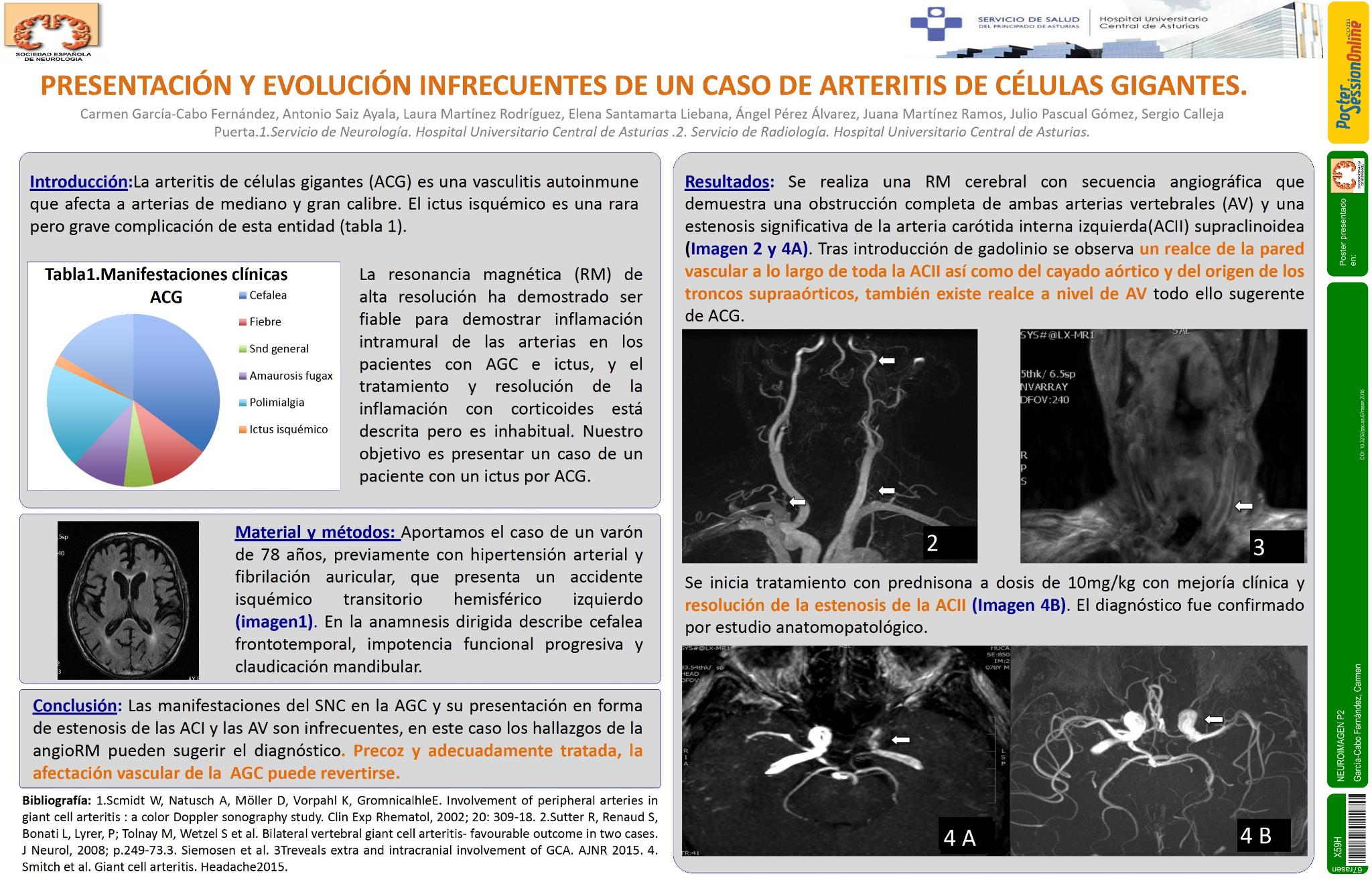 Presentación y evolución infrecuentes de un caso de arteritis de células gigantes