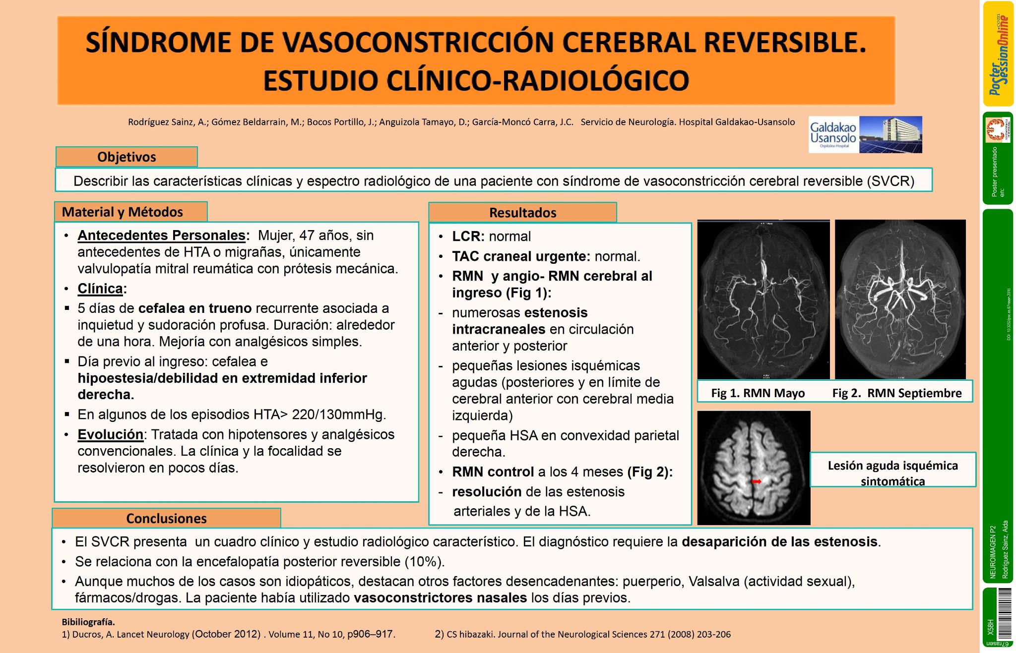 Síndrome de vasoconstricción cerebral reversible. Estudio clínico-radiológico