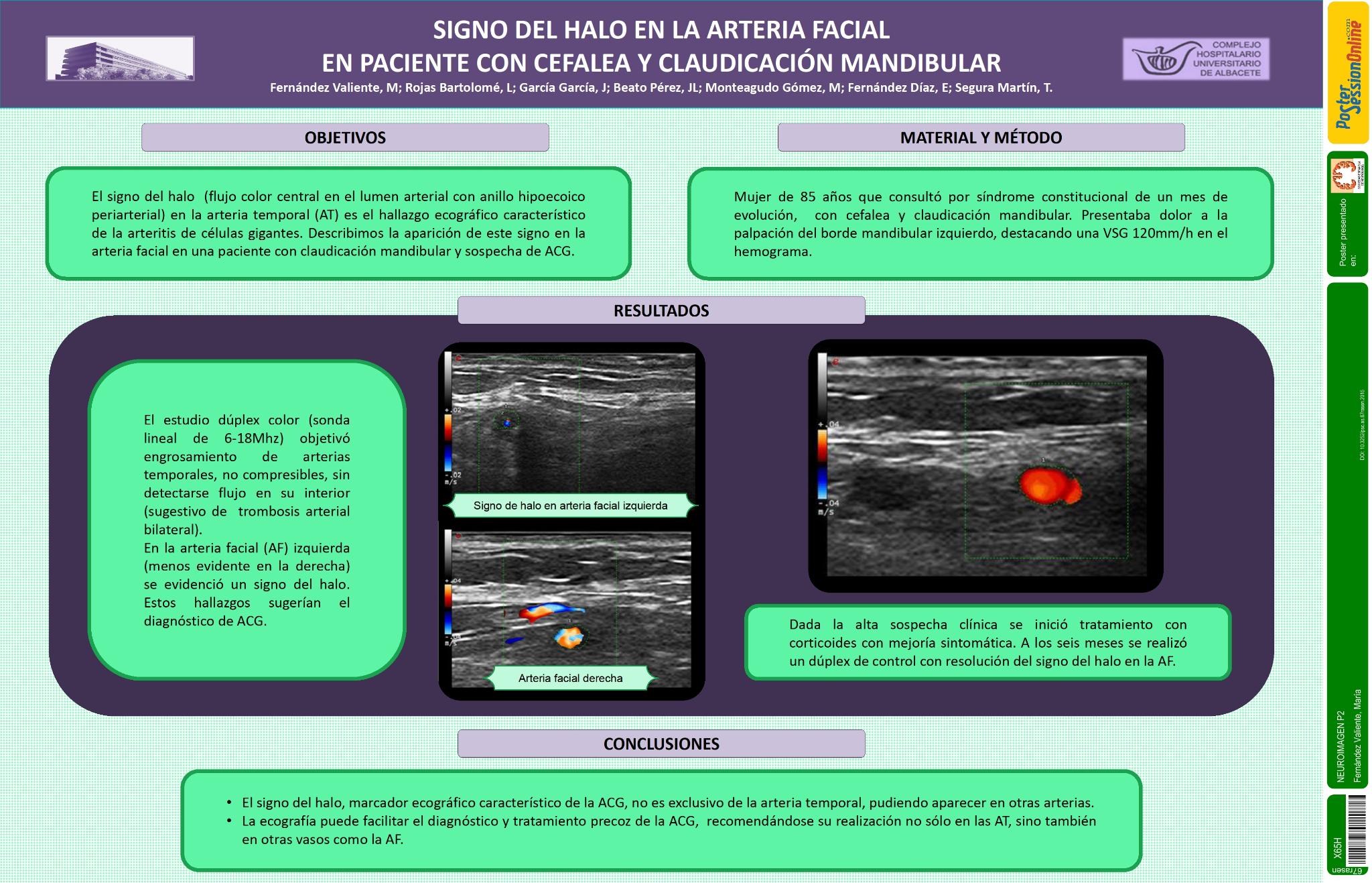 Signo del halo en la arteria facial en paciente con cefalea y claudicación mandibular