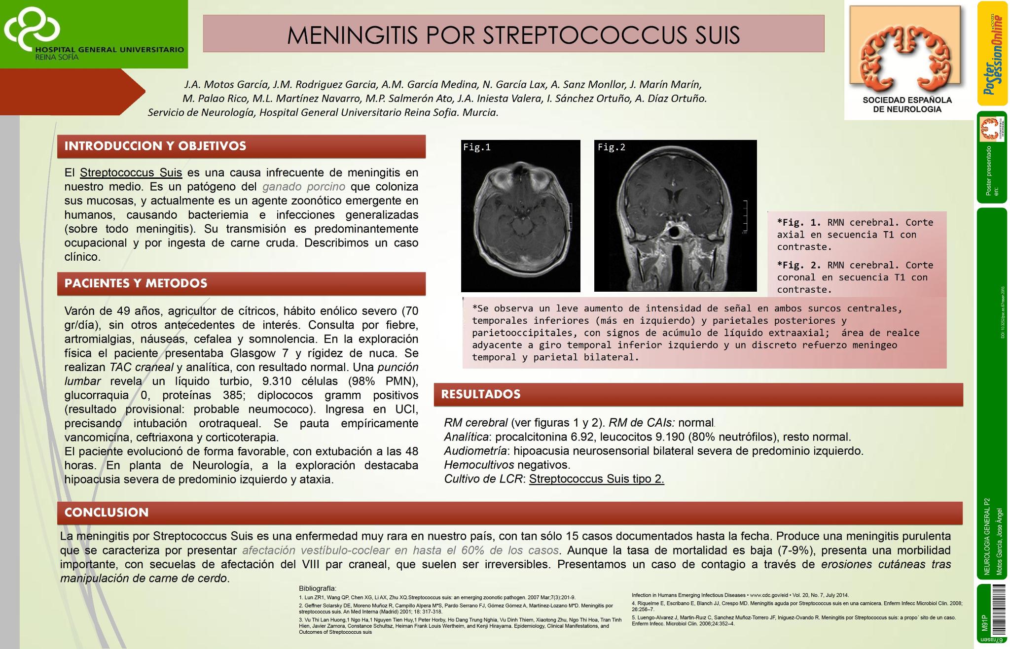 Meningitis por Streptococcus Suis