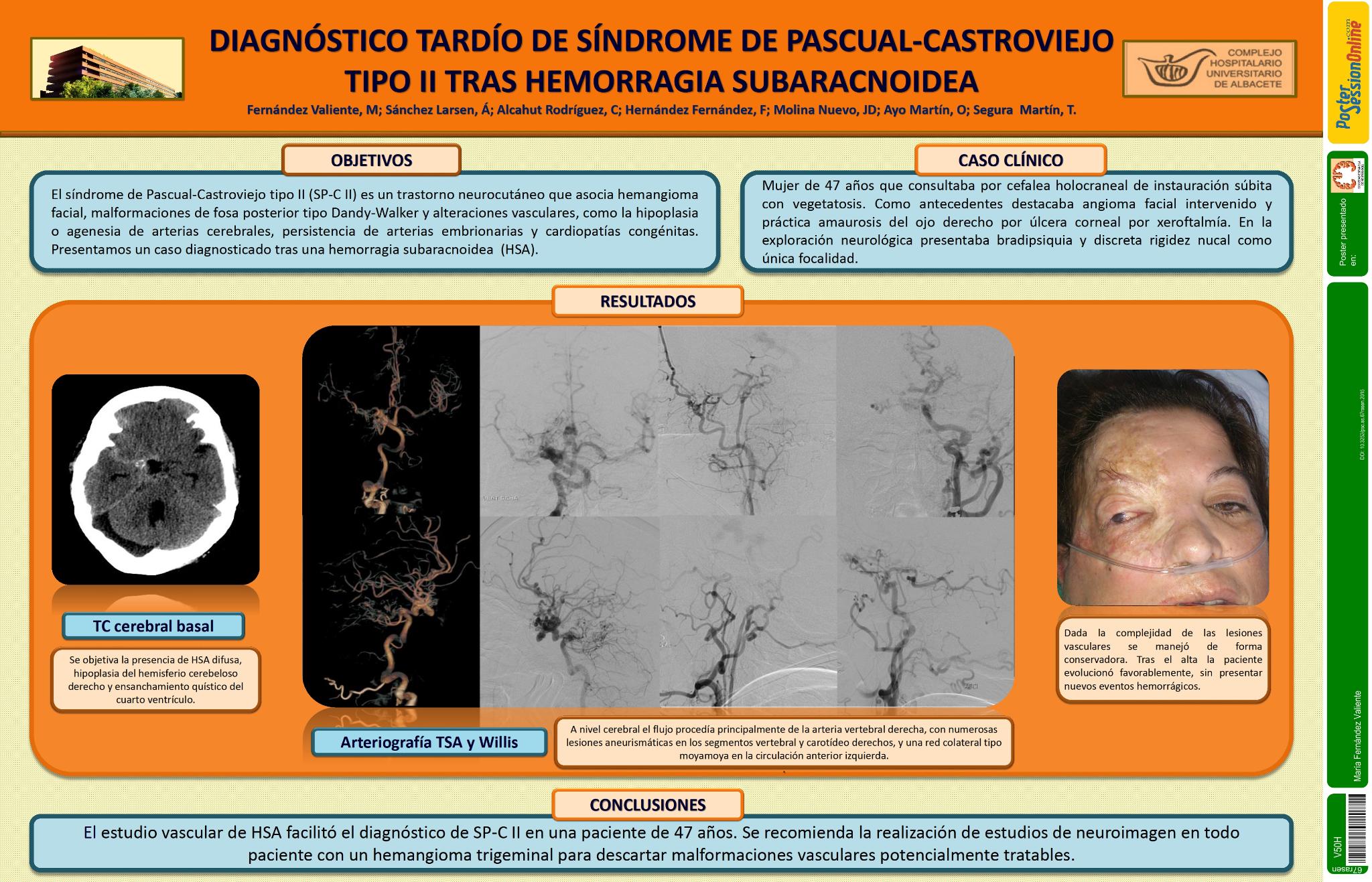 Diagnóstico tardío de síndrome de Pascual-Castroviejo tipo II tras hemorragia subaracnoidea