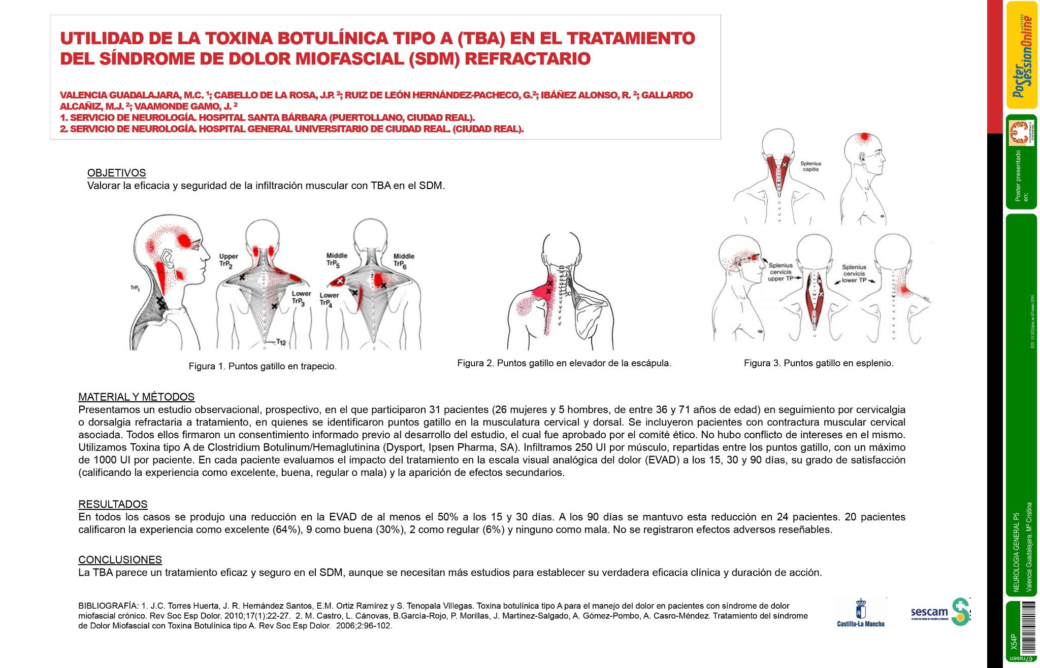 Utilidad de la toxina botulínicatipo a (TBA) en el tratamiento del síndrome de dolor miofascial (SDM) refractario