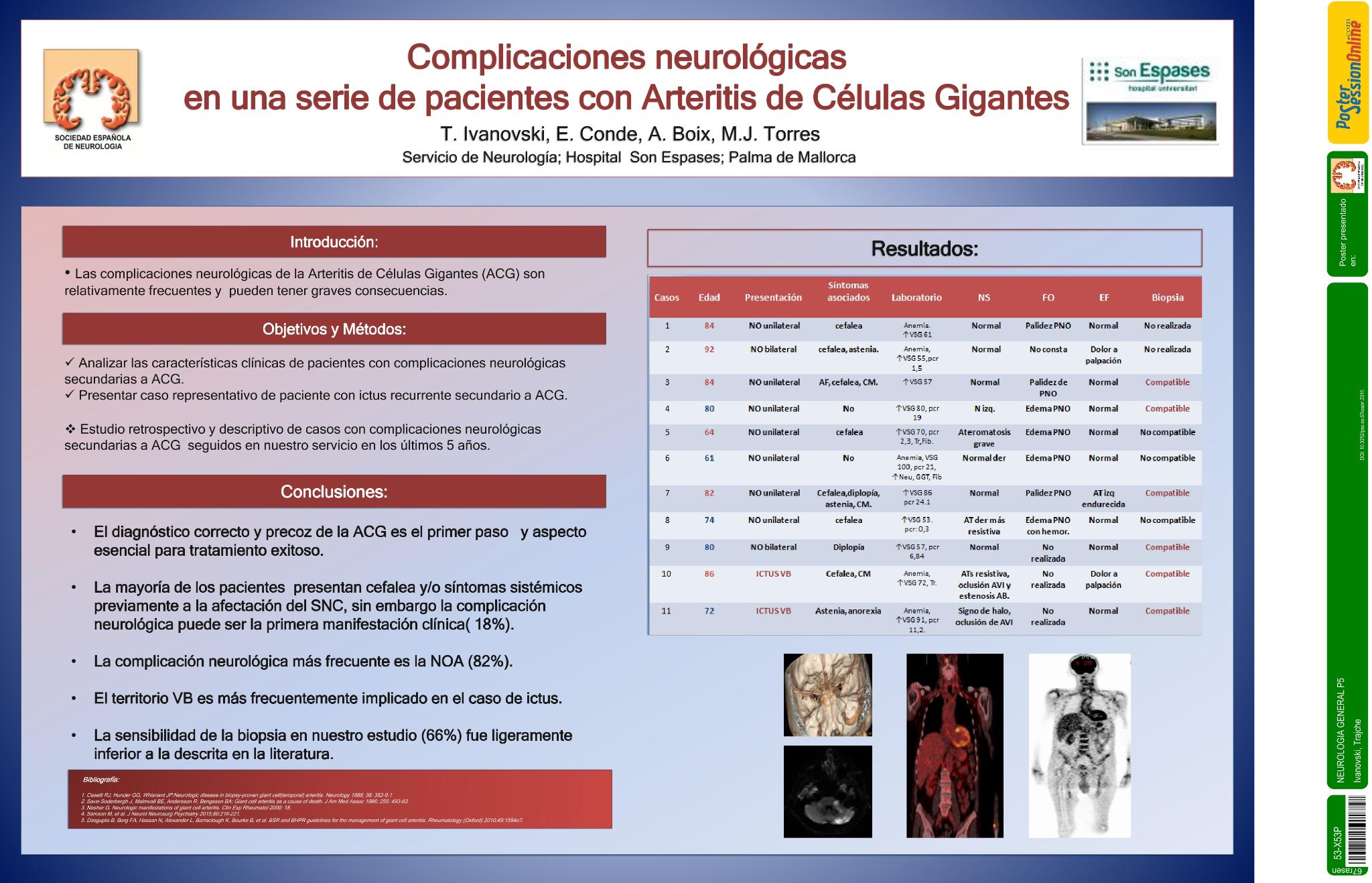 Complicaciones neurologicas en una serie de pacientes con arteritis de celulas gigantes