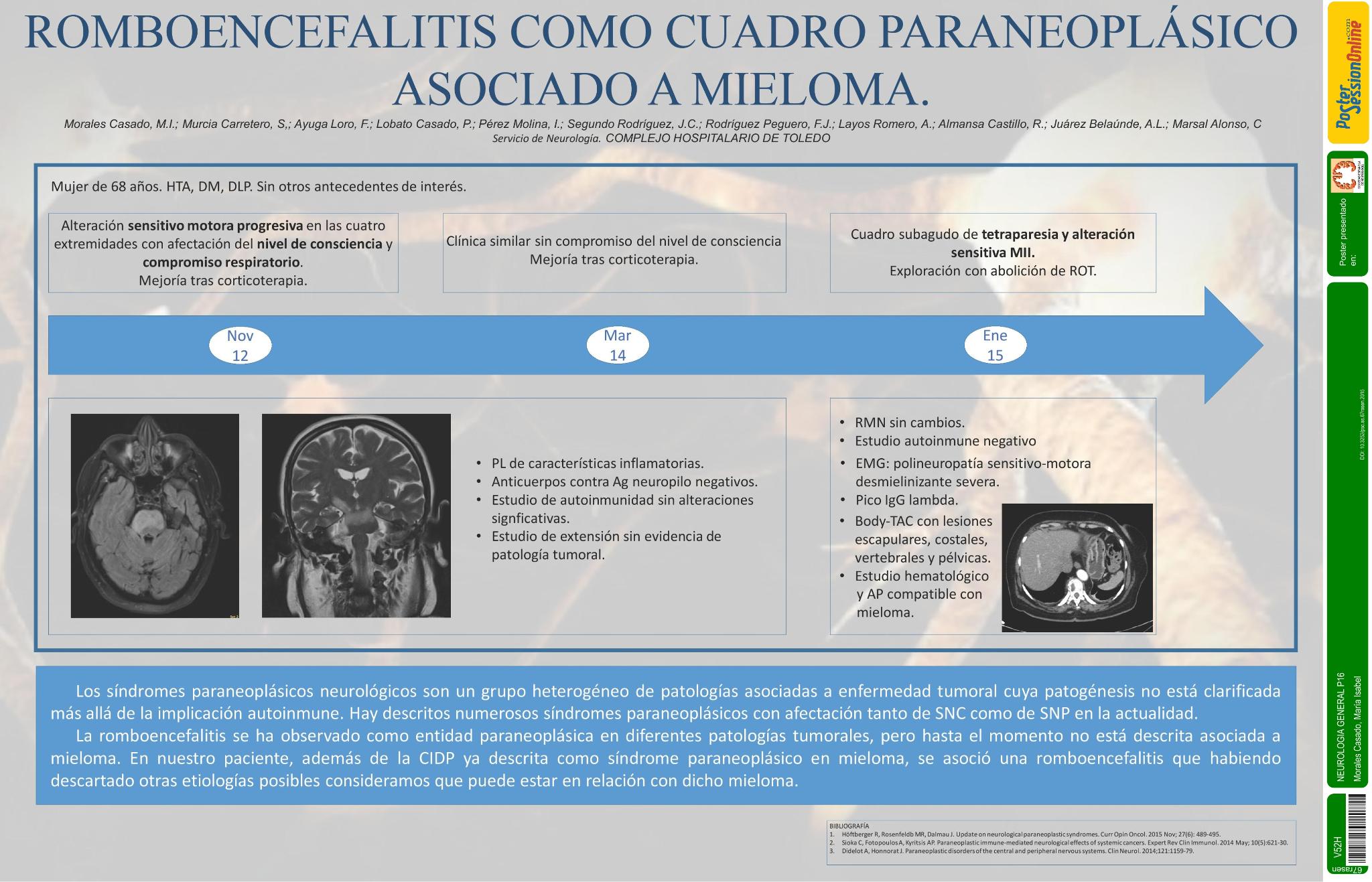 Romboencefalitis como cuadro paraneoplásico asociado a mieloma