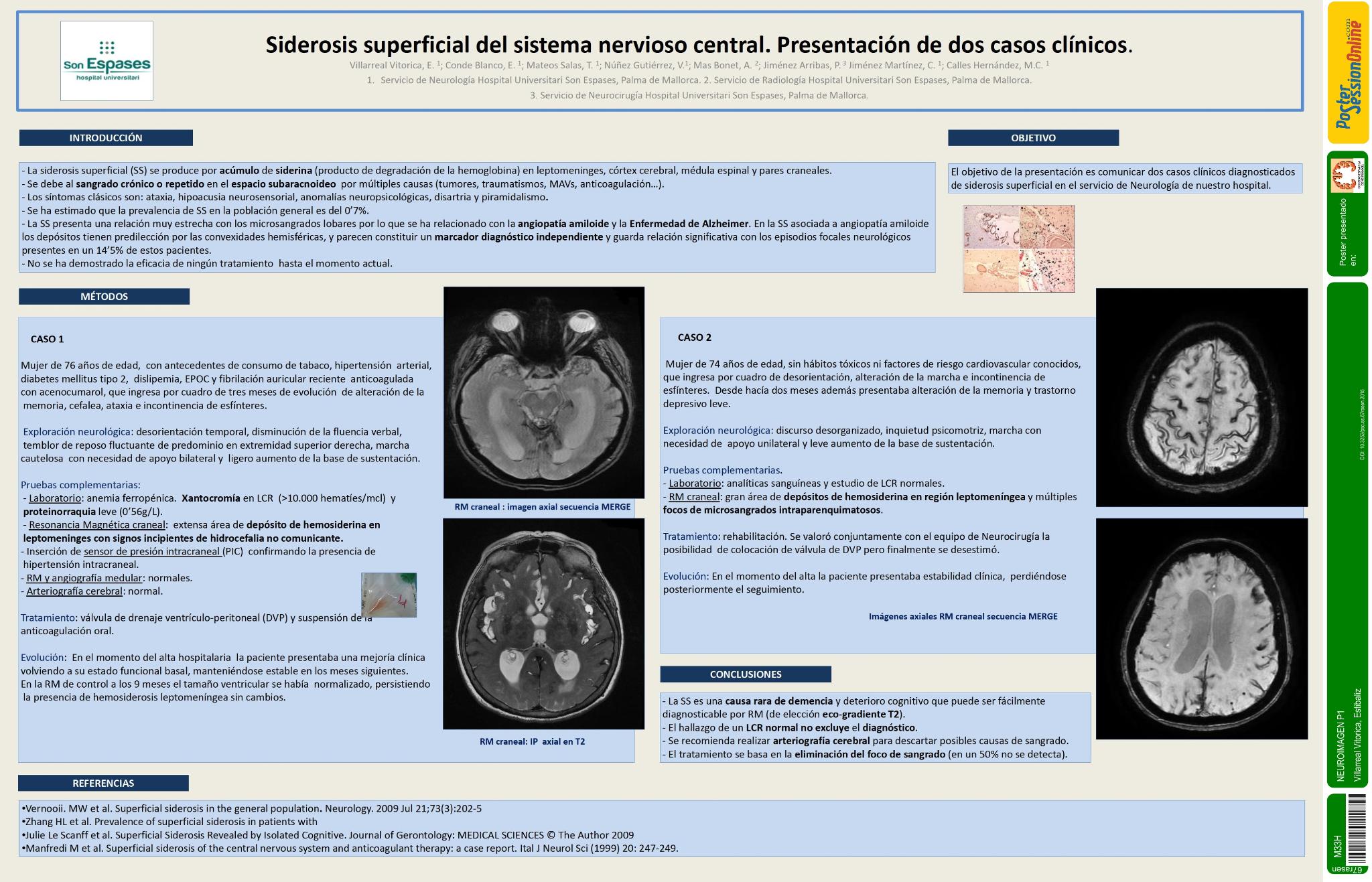 Siderosis superficial del sistema nervioso central. Presentación de dos casos clínicos
