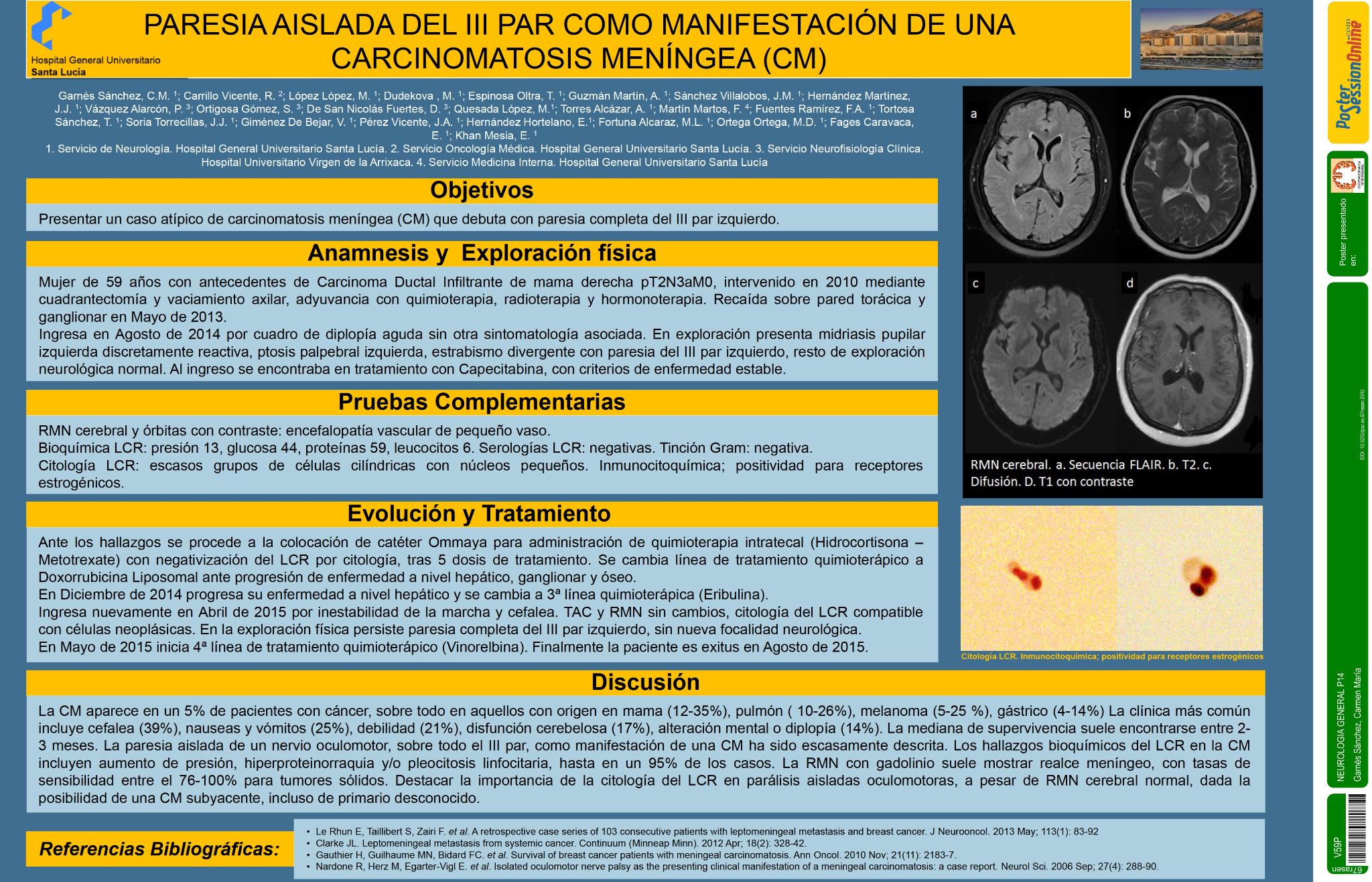 Paresia aislada del III par como manifestación de una carcinomatosis meníngea (CM)