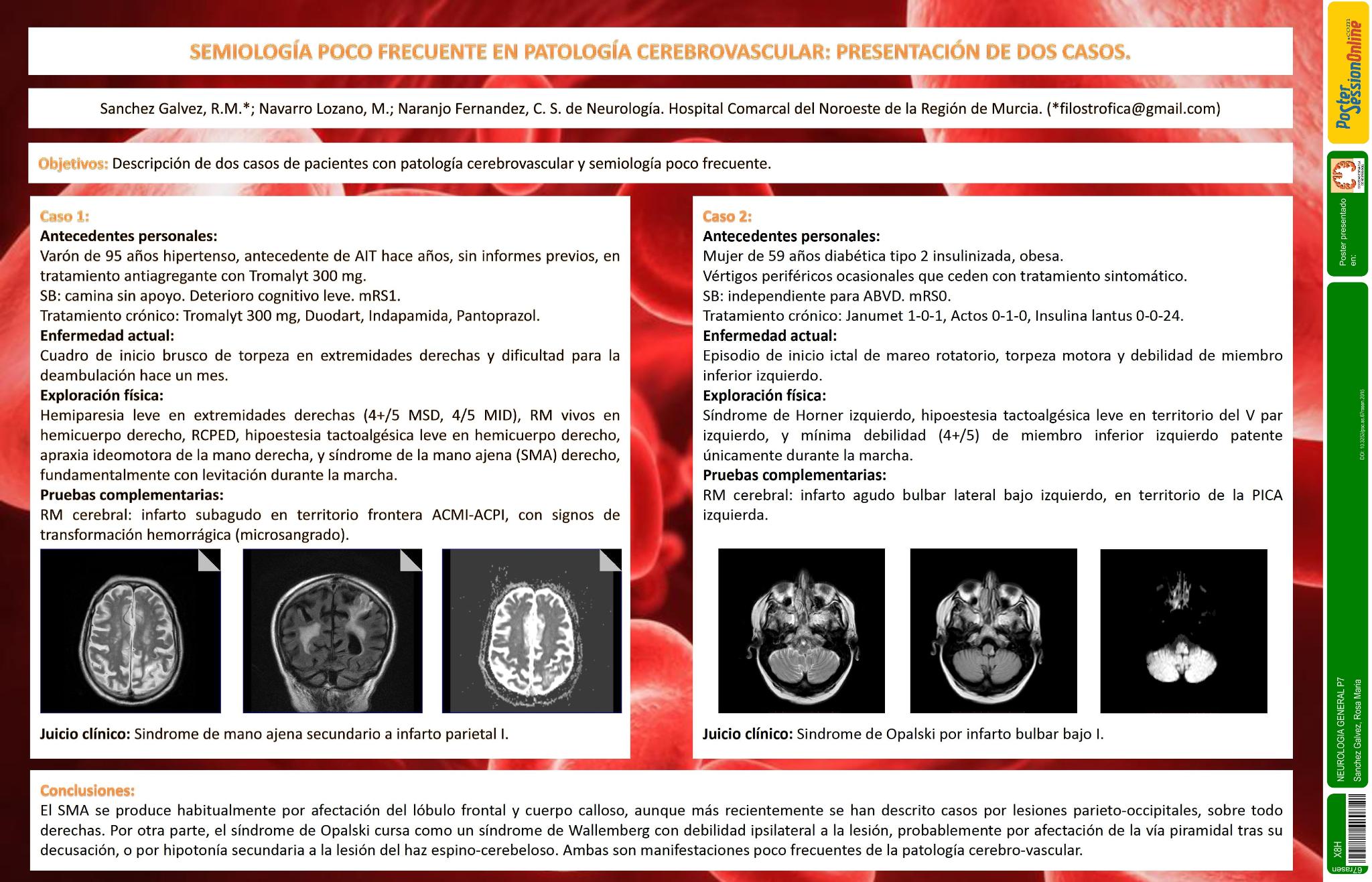 Semiología poco frecuente en patología cerebrovascular. Presentación de dos casos