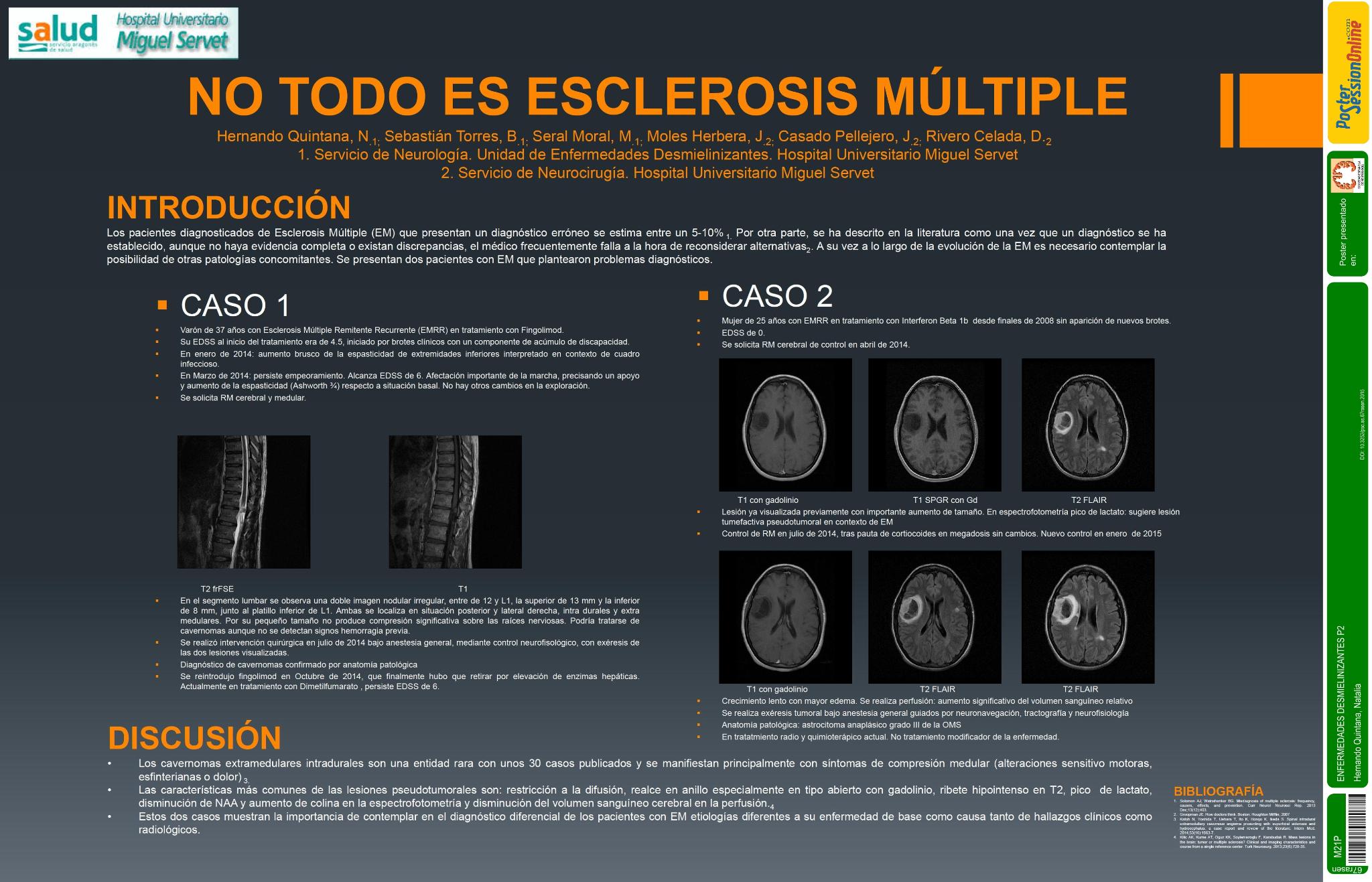 No todo es Esclerosis Múltiple