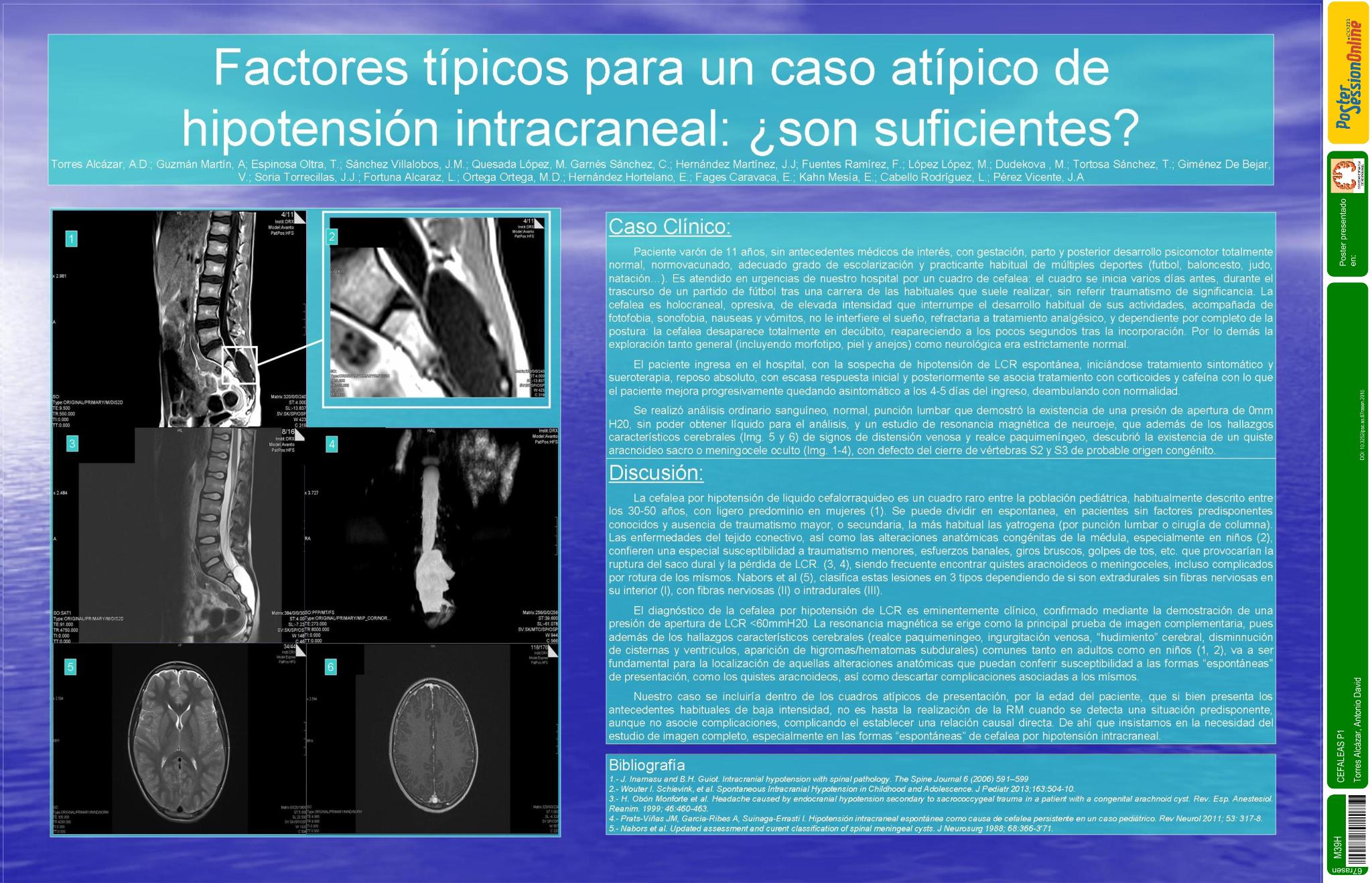 Factores típicos para un caso atípico de hipotension intracraneal: ¿son suficientes?