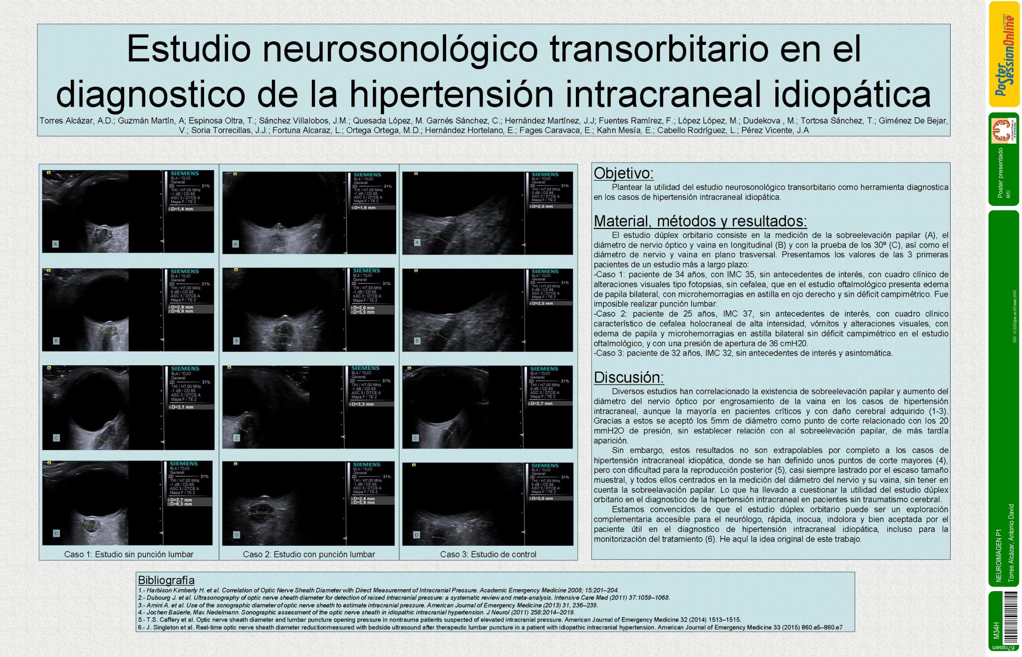 Estudio neurosonológico transorbitario en el diagnostico de la hipertensión intracraneal idiopática