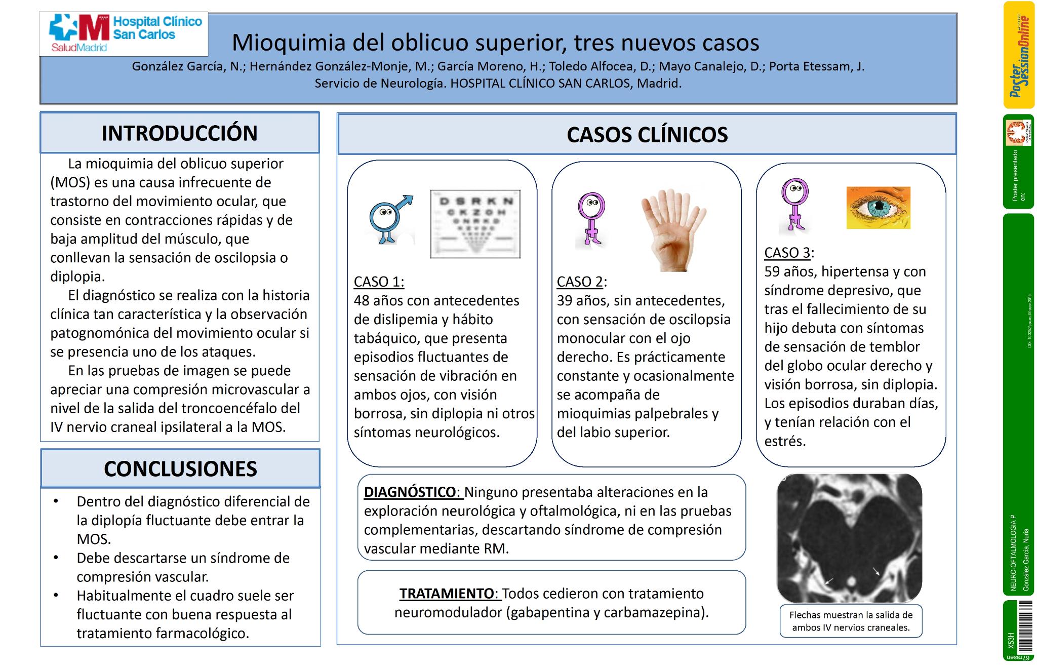 Mioquimia del oblicuo superior, tres nuevos casos