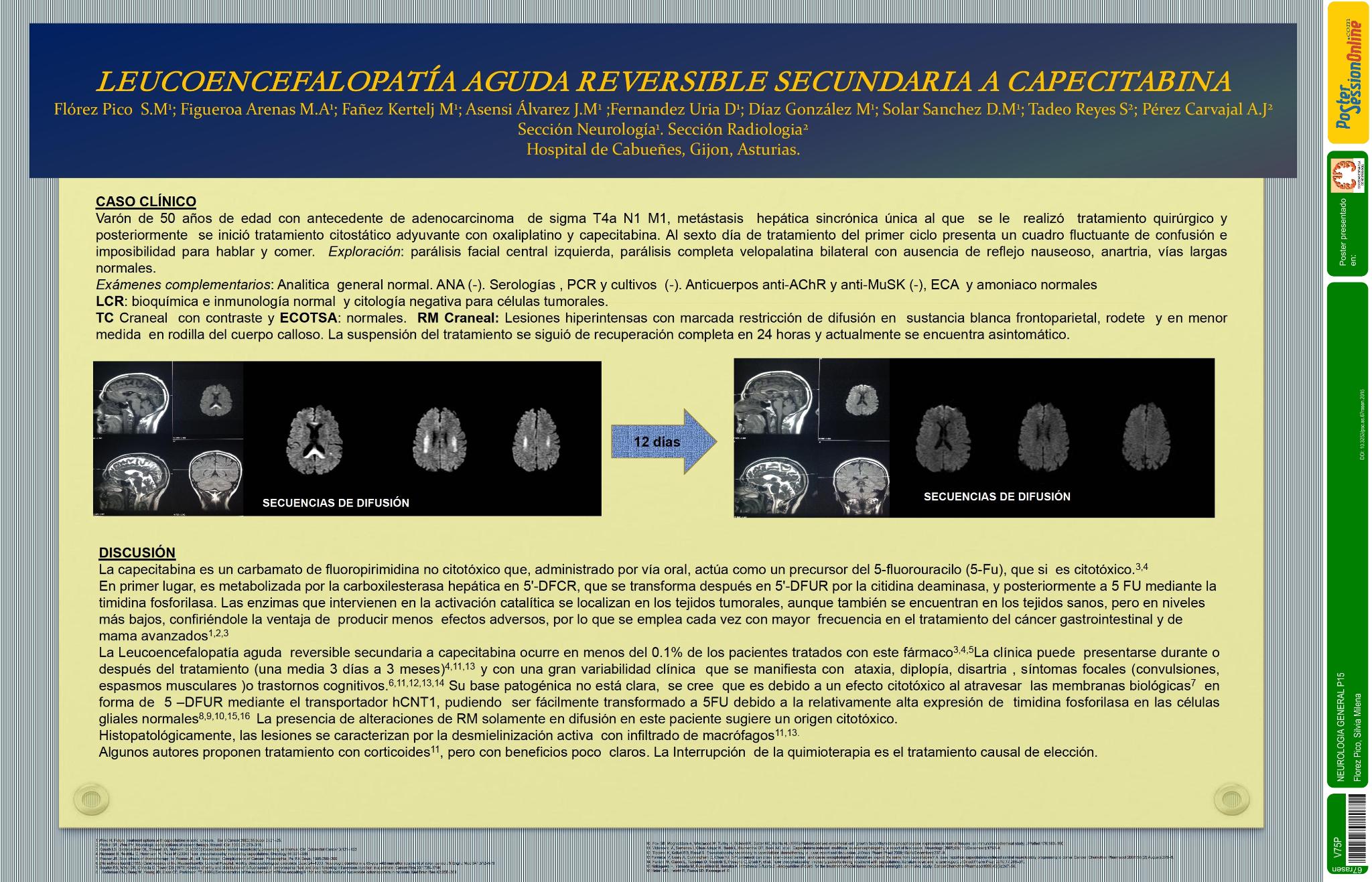 Leucoencefalopatía aguda reversible secundaria a capecitabina