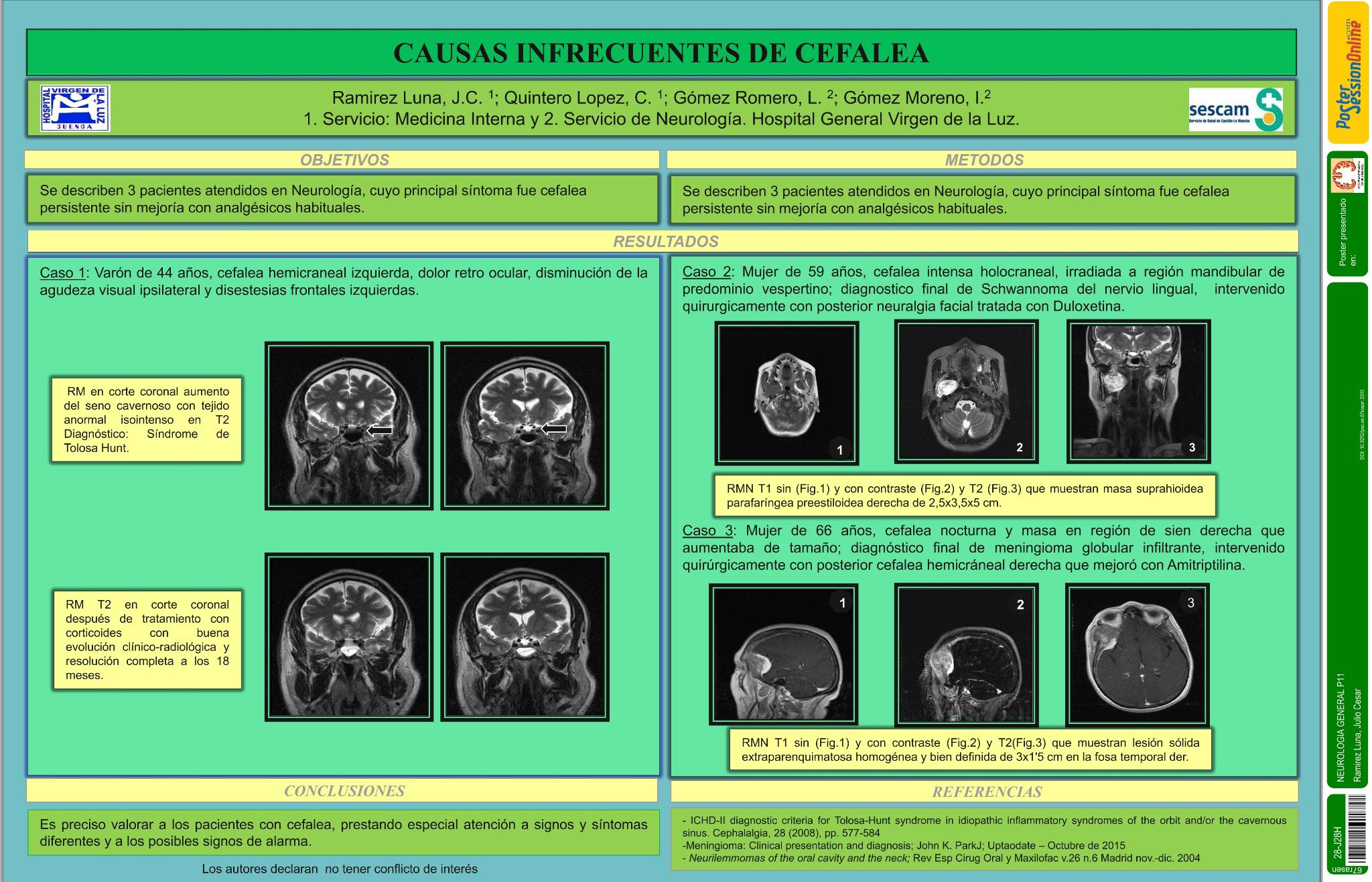 Causas infrecuentes de cefalea