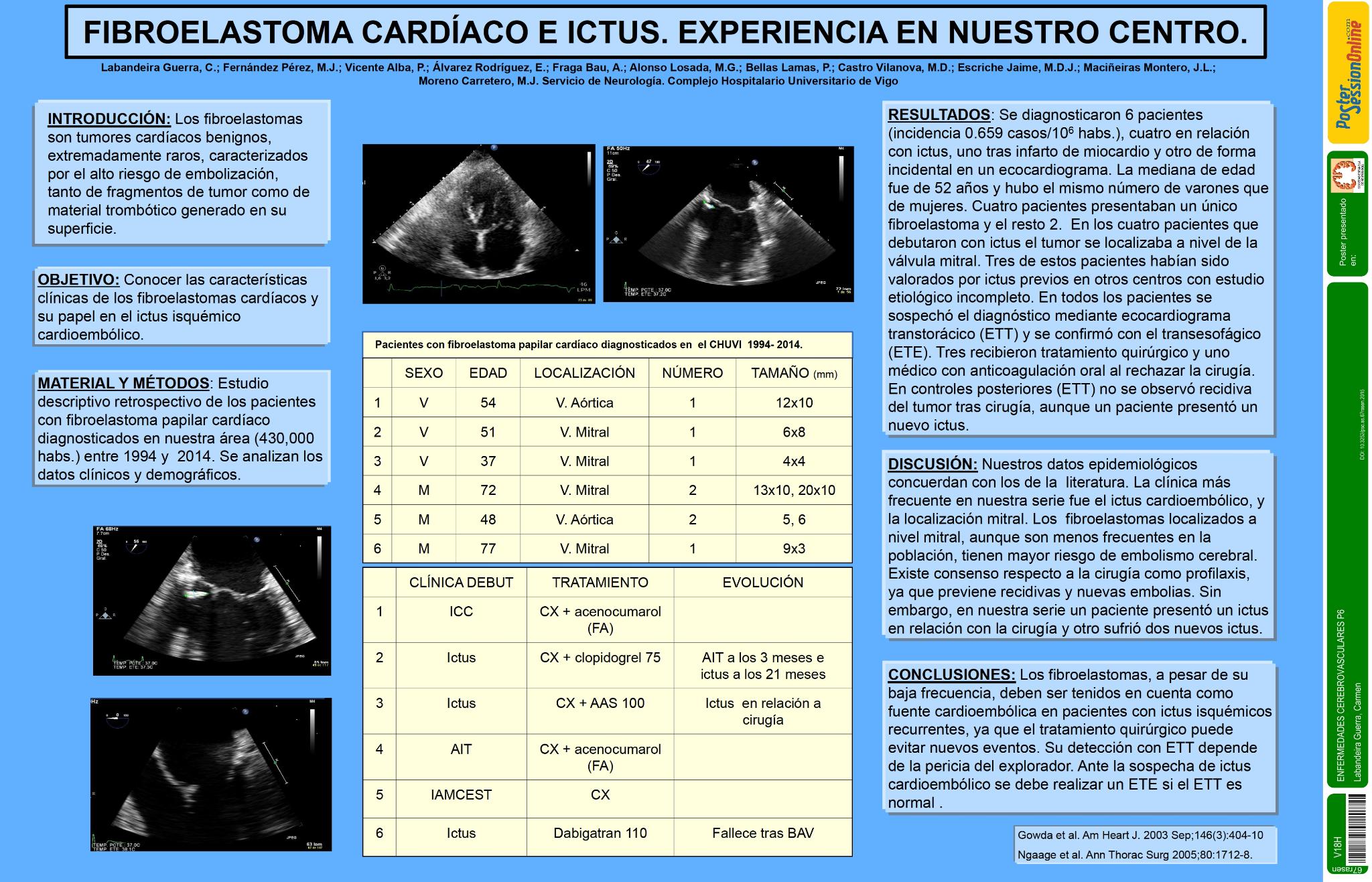 Fibroelastoma cardíaco e ictus. Experiencia en nuestro centro