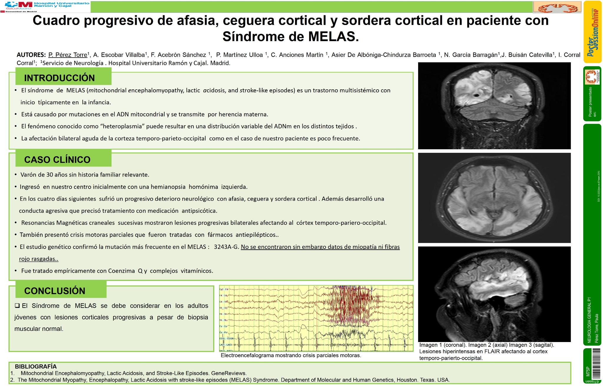 Cuadro progresivo de afasia, ceguera y sordera cortical en paciente con Síndrome de MELAS