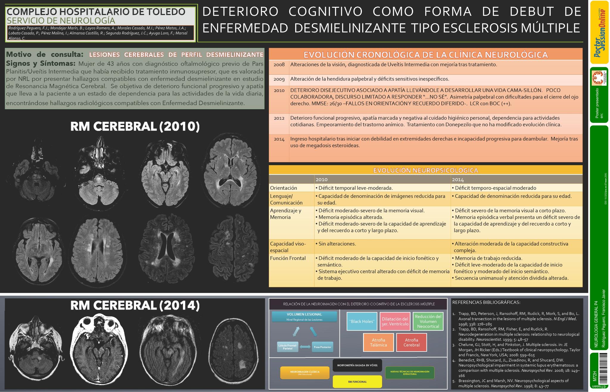 Deterioro cognitivo como forma de debut de Enfermedad Desmielinizante tipo Esclerosis Multiple