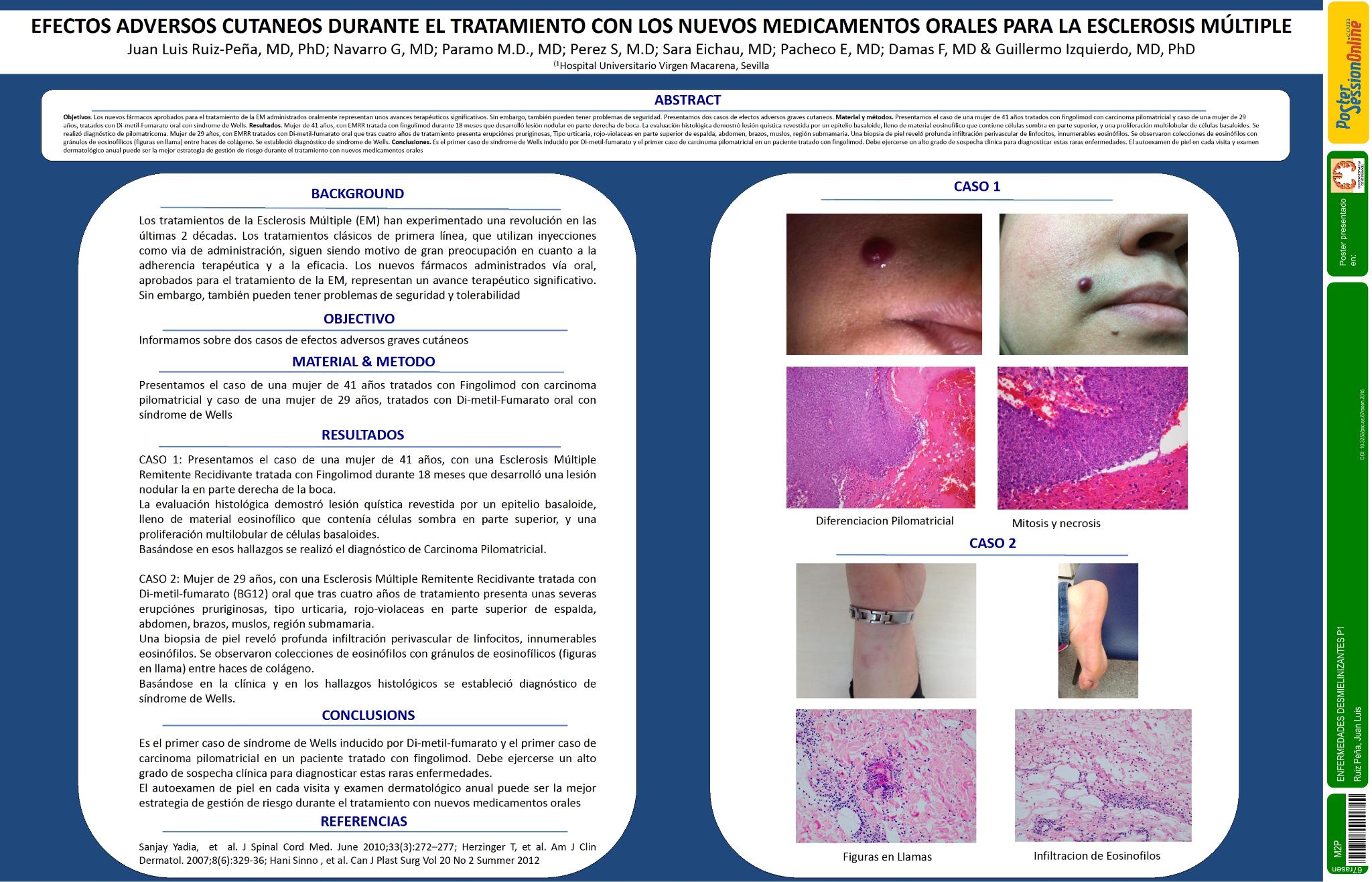 Efectos adversos cutaneos durante el tratamiento con los nuevos medicamentos orales para la Esclerosis Múltiple