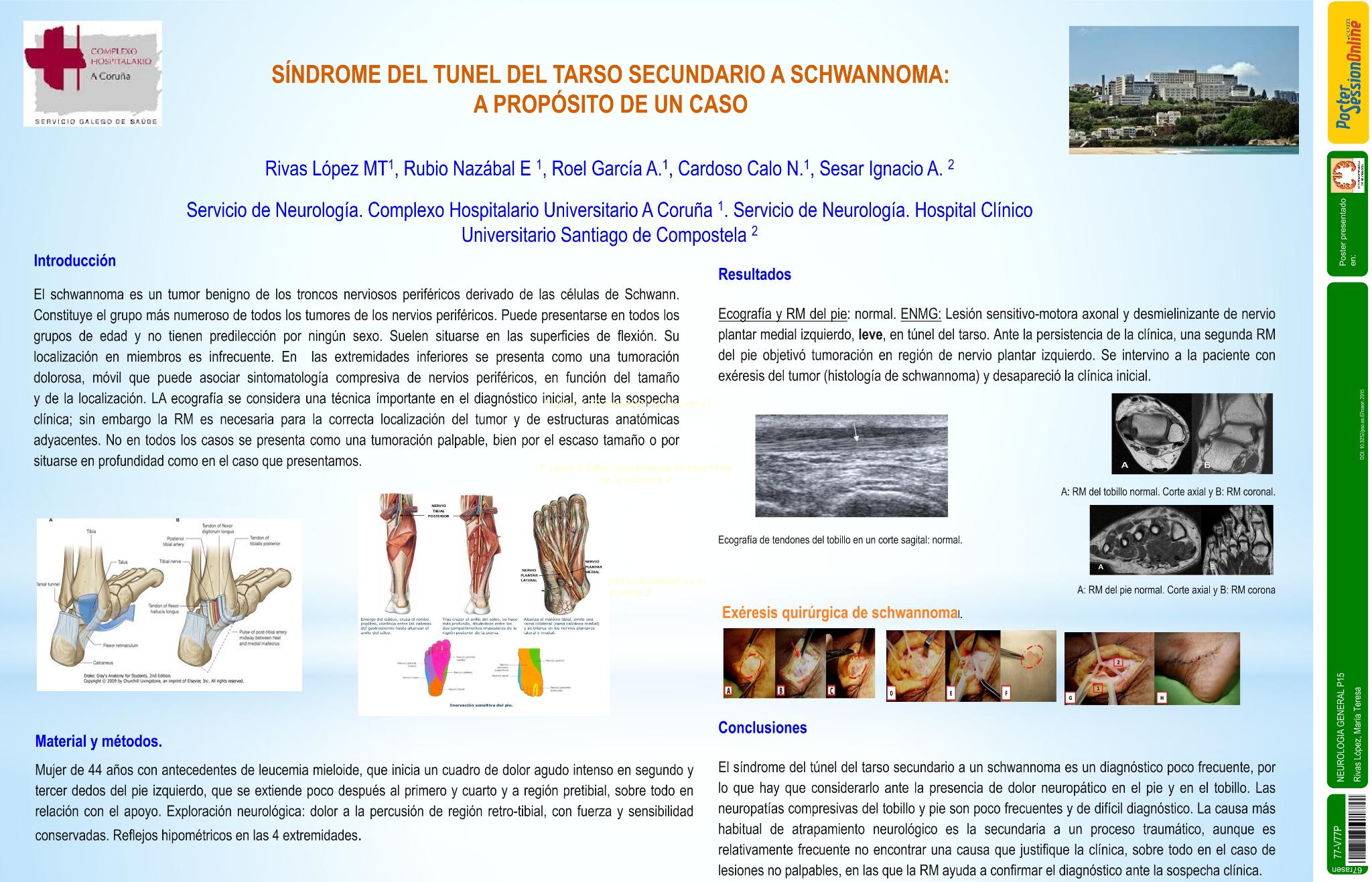 Síndrome del tunel del tarso secundario a swchamnoma: a propósito de un caso