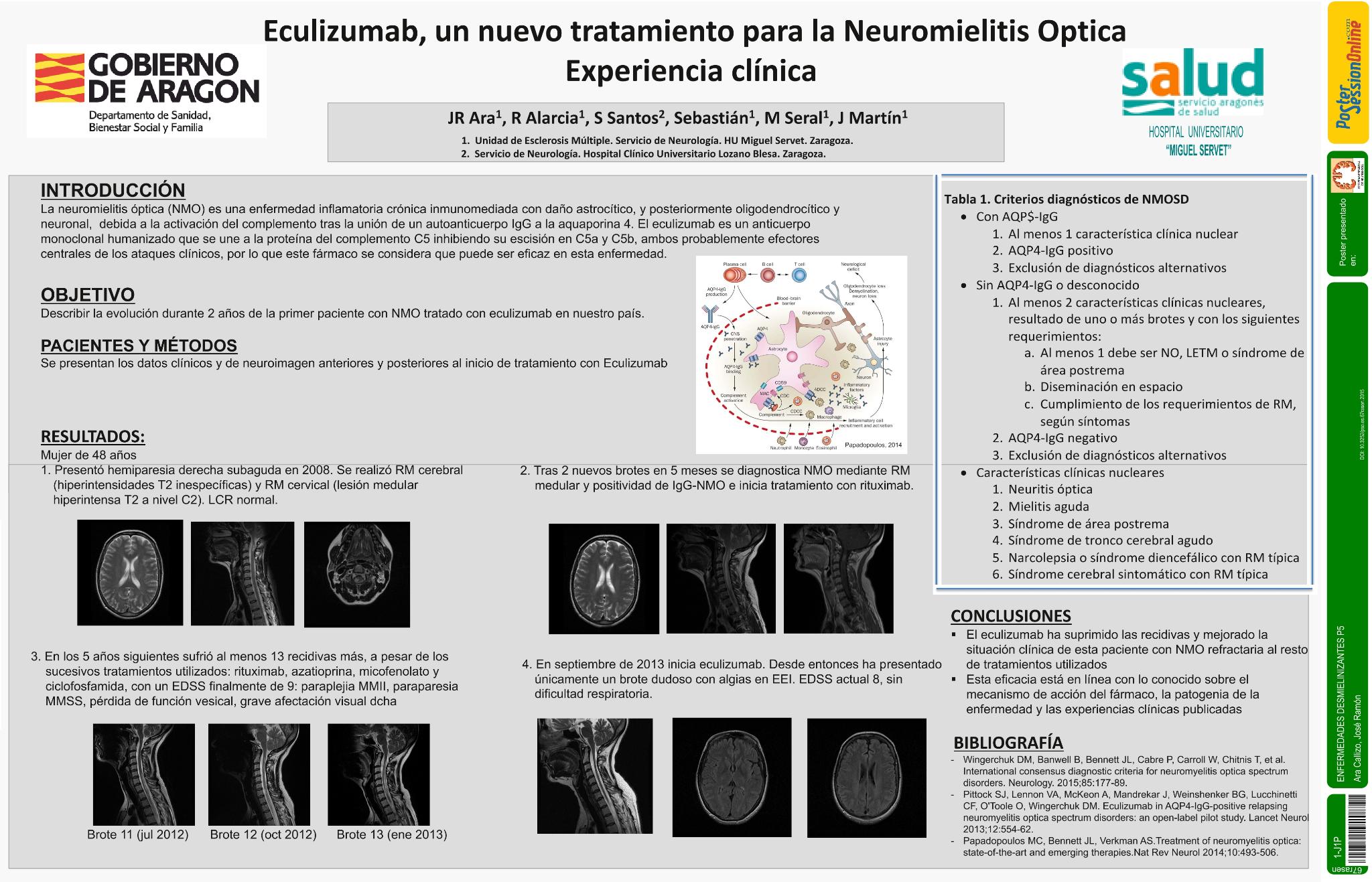 Eculizumab, un nuevo tratamiento para la Neuromielitis Optica. Experiencia clínica