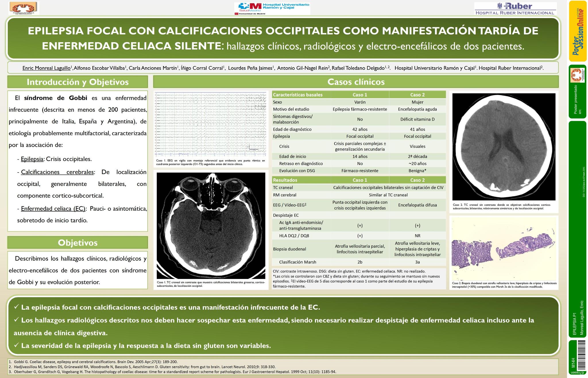 Epilepsia focal con calcificaciones occipitales como manifestación tardía de enfermedad celiaca “oculta”: hallazgos clínicos, radiológicos y electroencefalográficos en dos pacientes