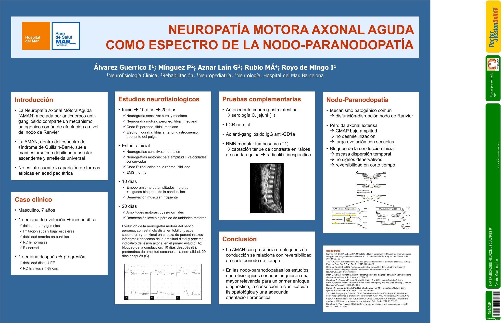 Neuropatía motora axonal aguda como espectro de la nodo-paranodopatía