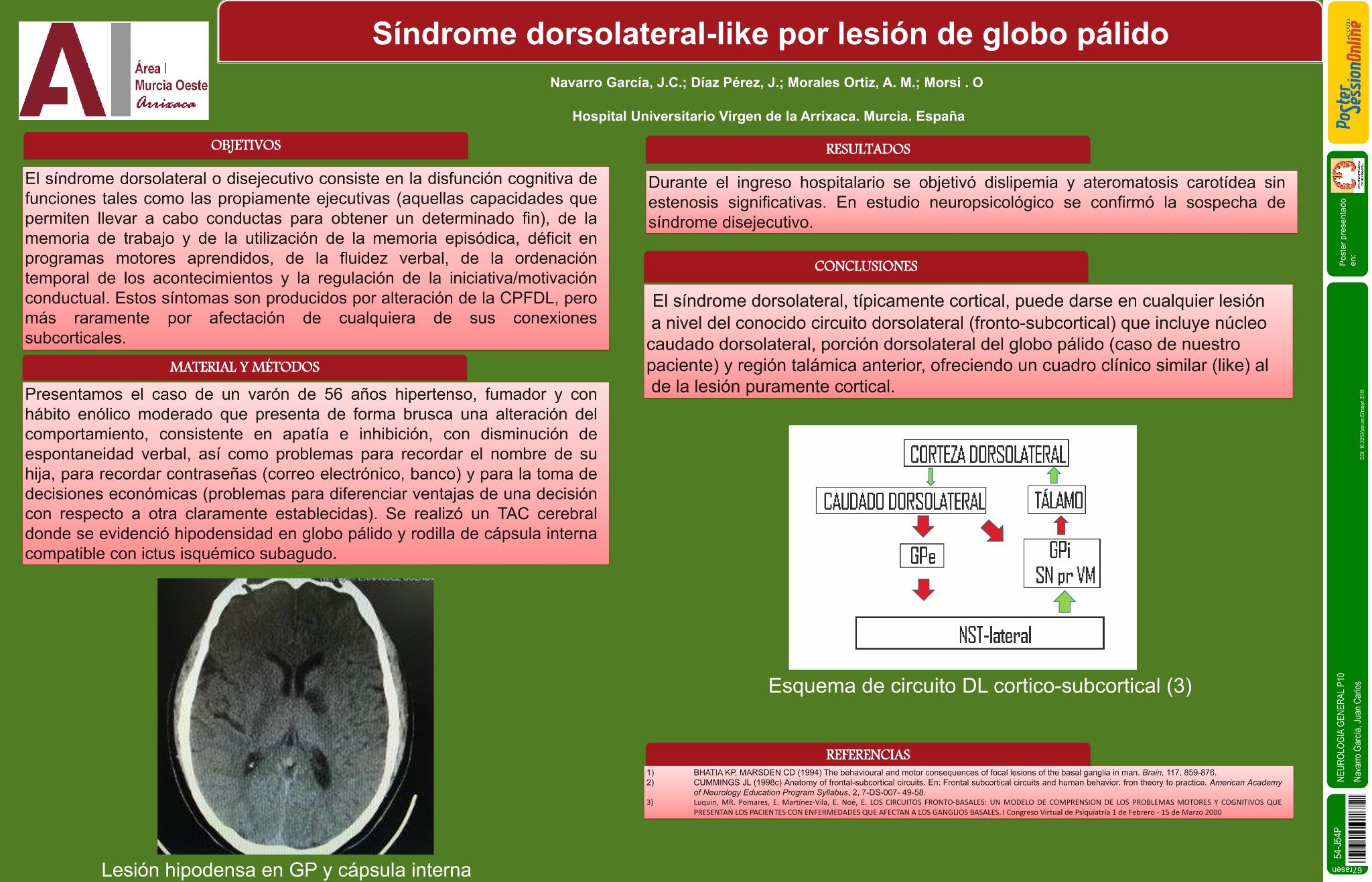 Síndrome dorsolateral-like por lesión de globo pálido