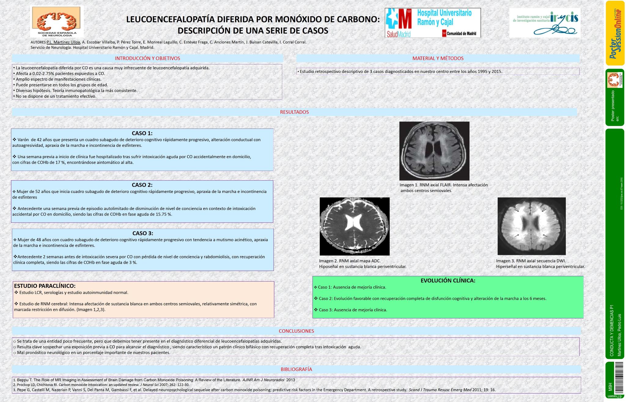 Leucoencefalopatía diferida por monóxido de carbono: descripción de una serie de casos