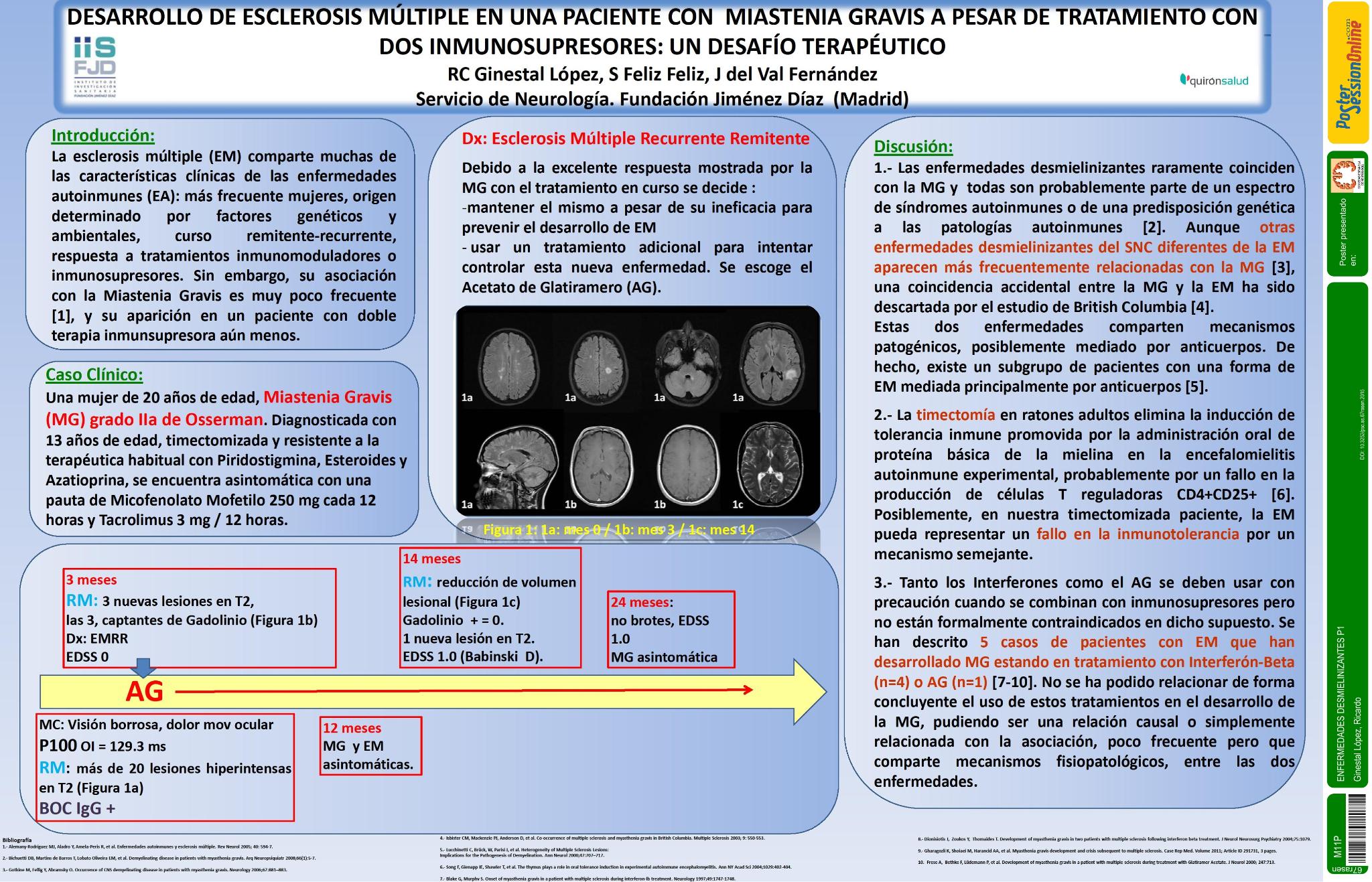 Desarrollo de Esclerosis Múltiple en una paciente con Miastenia Gravis a pesar de tratamiento con dos inmunosupresores: un desafío terapéutico