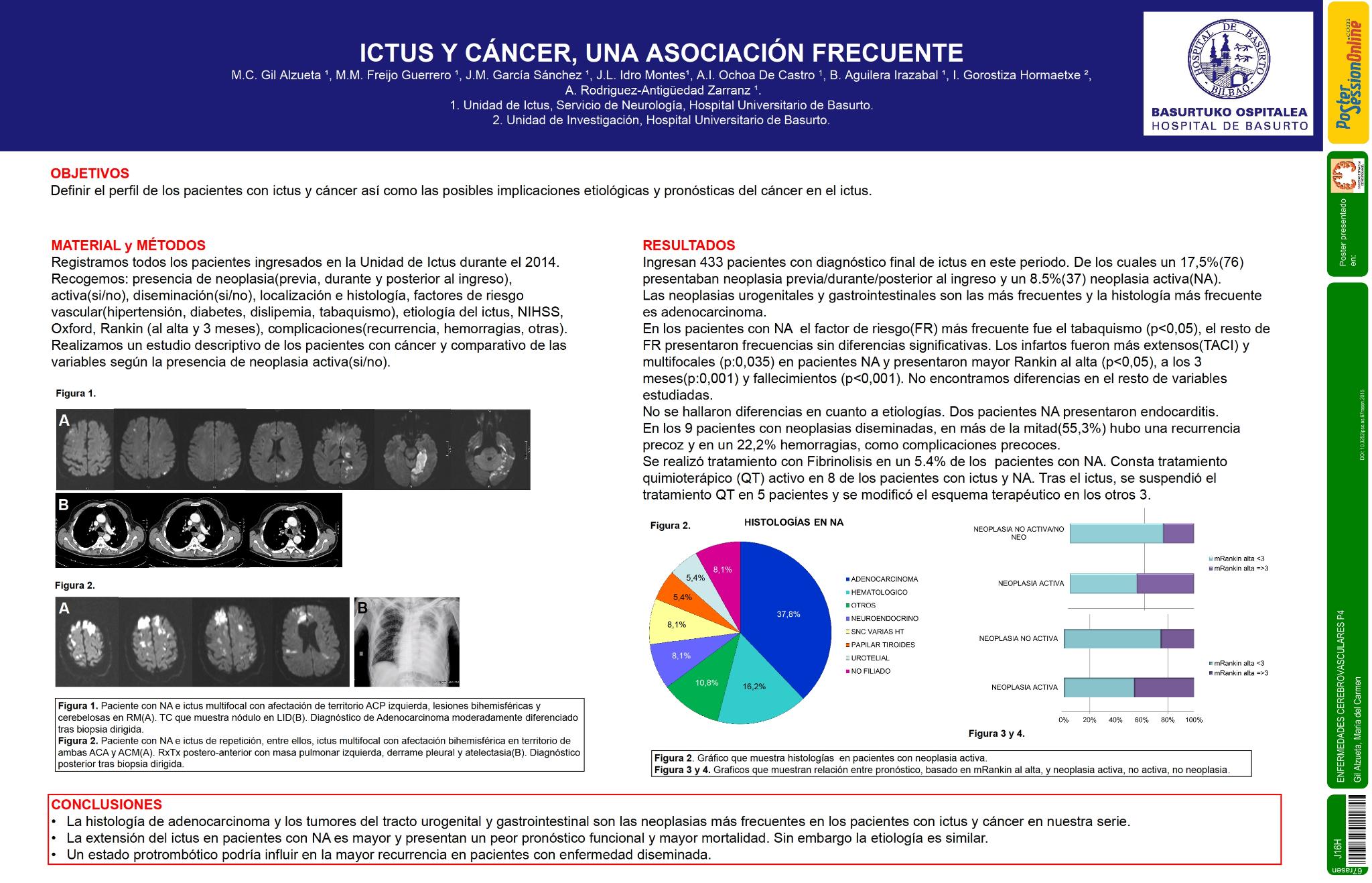 Ictus y cáncer, una asociación frecuente