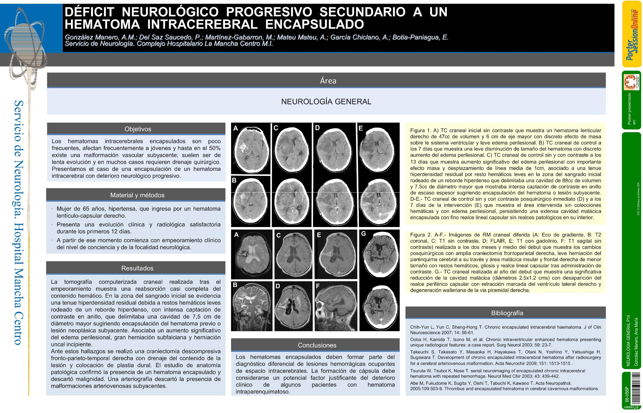 Déficit neurológico progresivo secundario a un hematoma intracerebral encapsulado