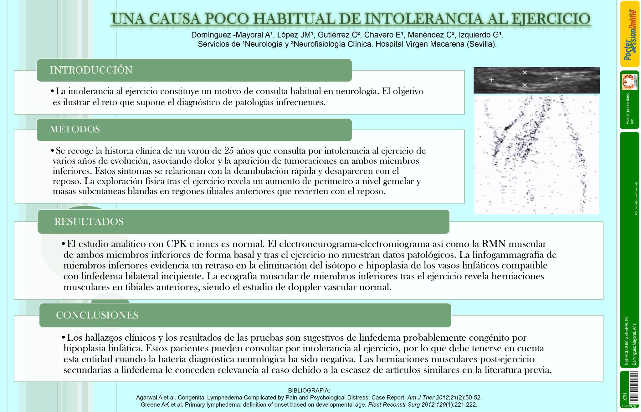 Una causa poco habitual de intolerancia al ejercicio