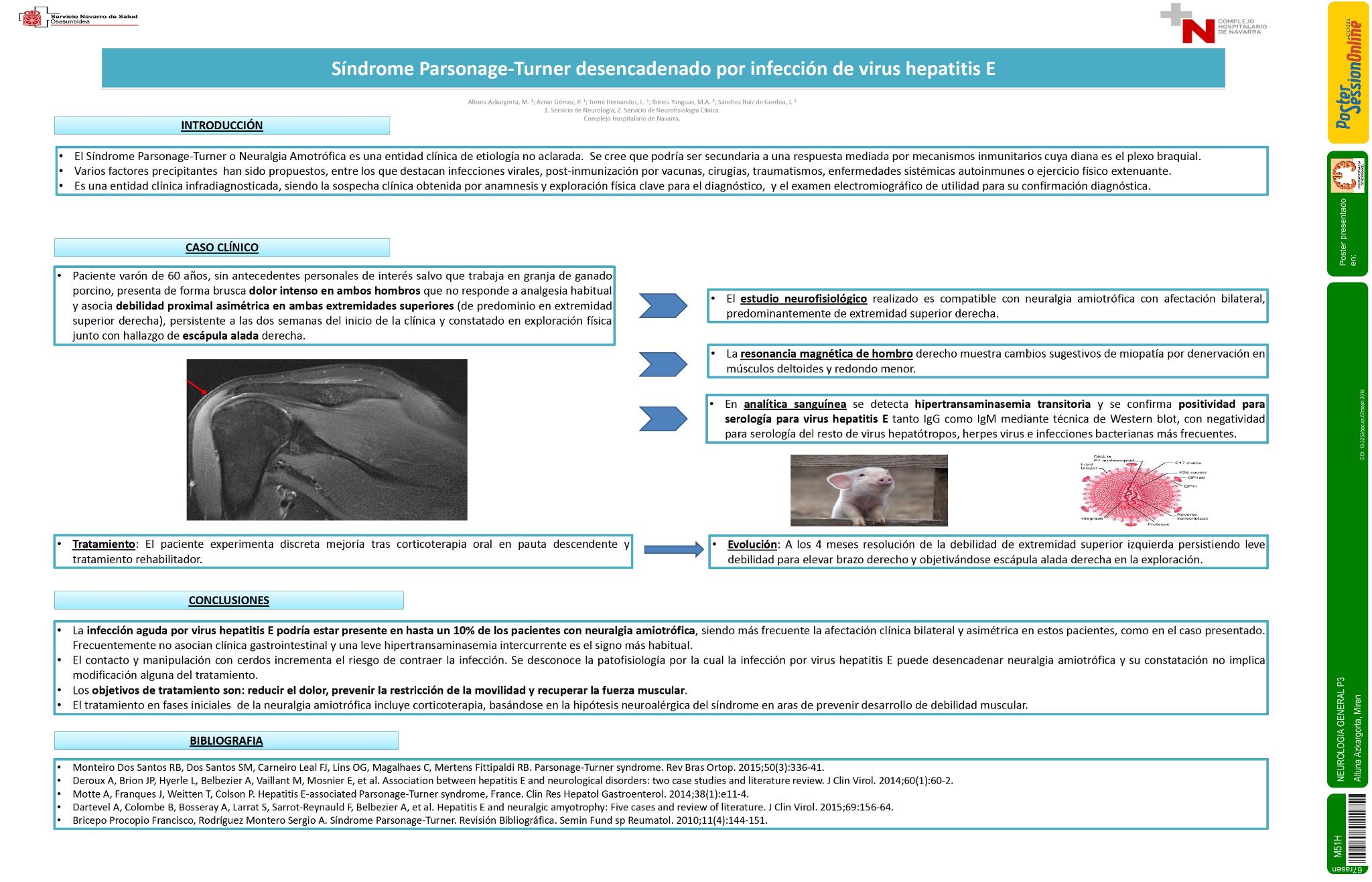 Síndrome Parsonage-Turner desencadenado por infección de virus hepatitis E