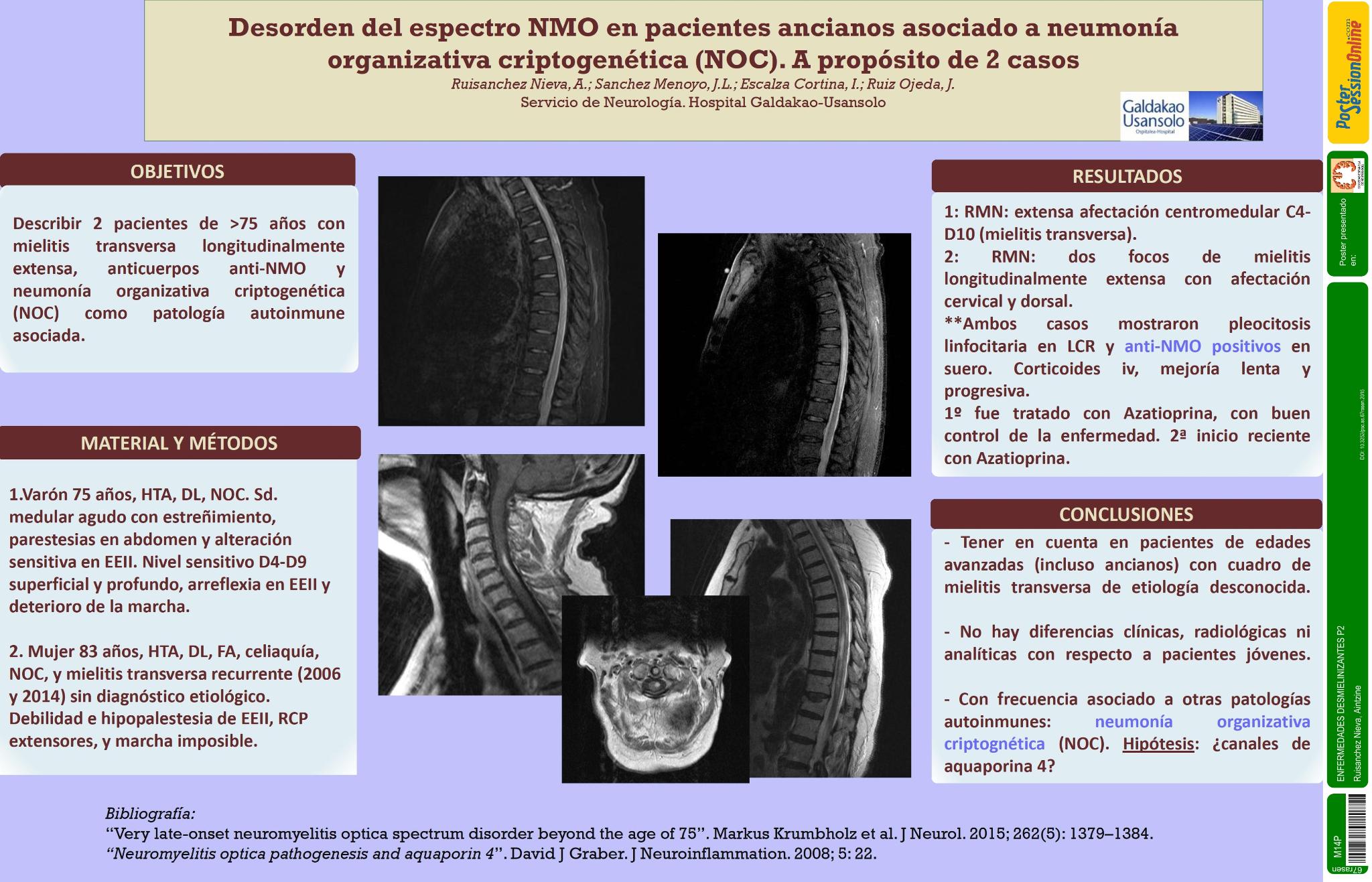 Desorden del espectro NMO en pacientes ancianos asociado a neumonía organizativa criptogenética (NOC). A propósito de 2 casos