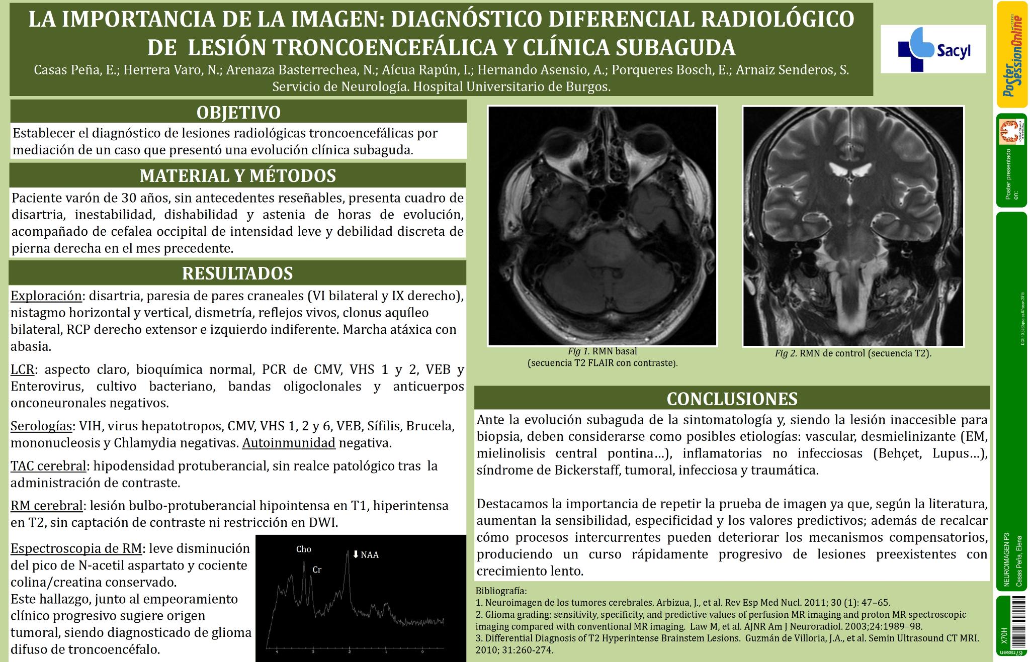 La importancia de la imagen: diagnóstico diferencial radiológico de lesión troncoencefálica y clínica subaguda