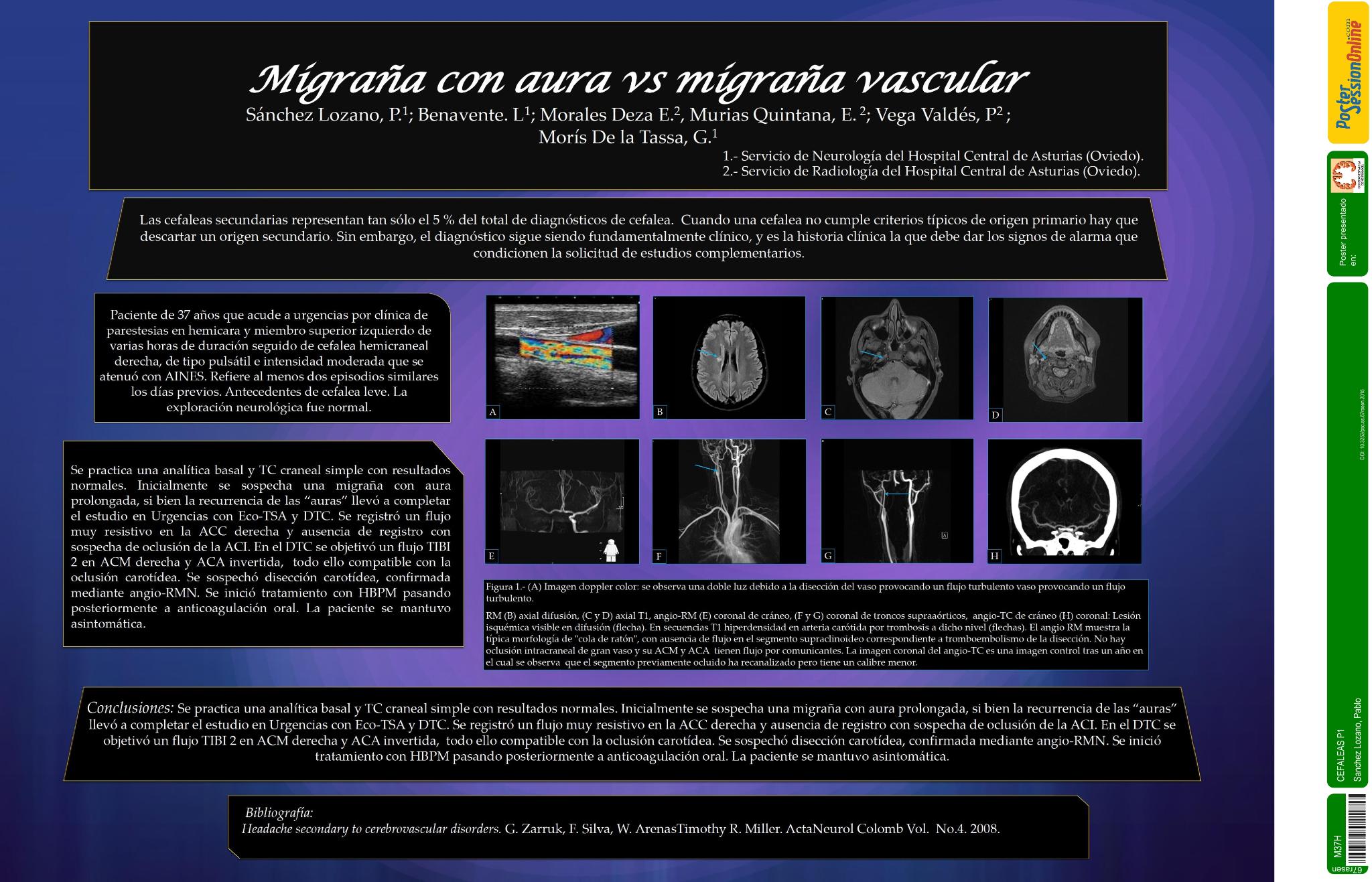 Migraña con aura vs cefalea vascular