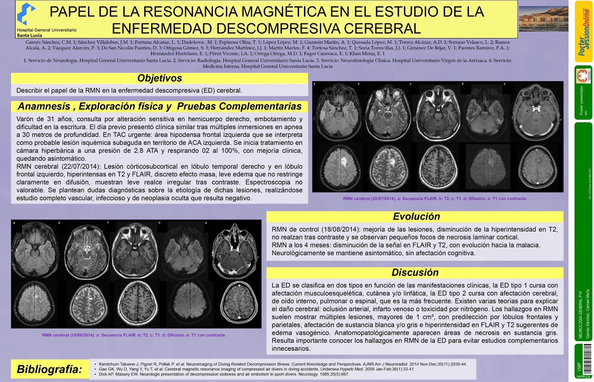 Papel de la resonancia magnética en el estudio de la enfermedad descompresiva cerebral