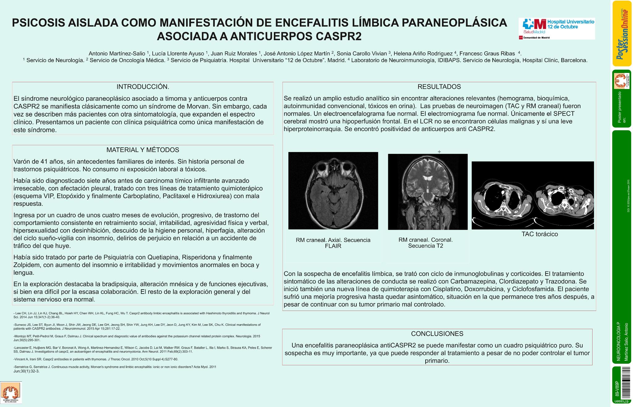 Psicosis aislada como manifestación de encefalitis límbica paraneoplásica asociada a anticuerpos anti caspr2