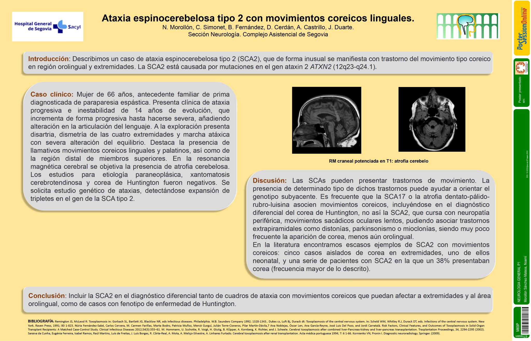 Ataxia espinocerebelosa tipo 2 con movimientos coreicos orolinguales