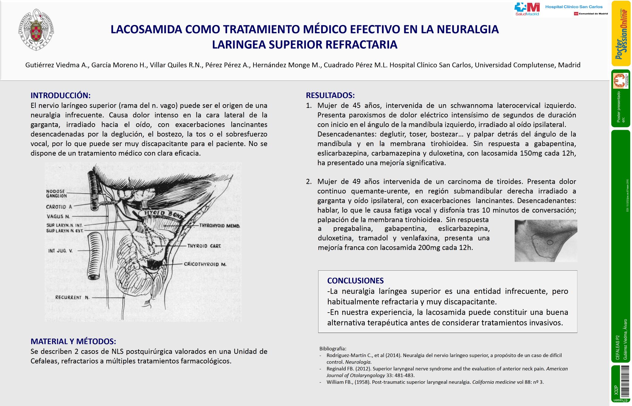 Lacosamida como tratamiento médico efectivo en la neuralgia laringea superior refractaria