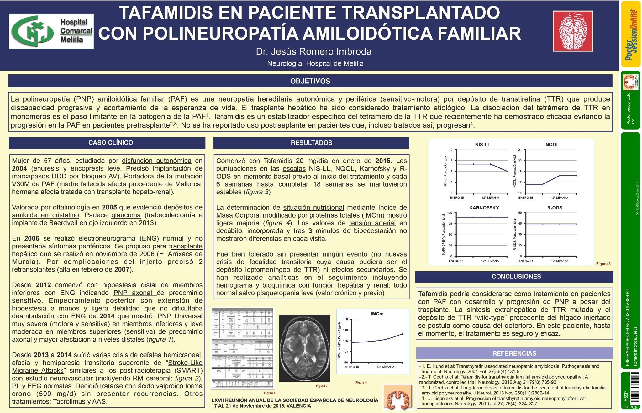 Tafamidis en paciente trasplantado con polineuropatía amiloidótica familiar